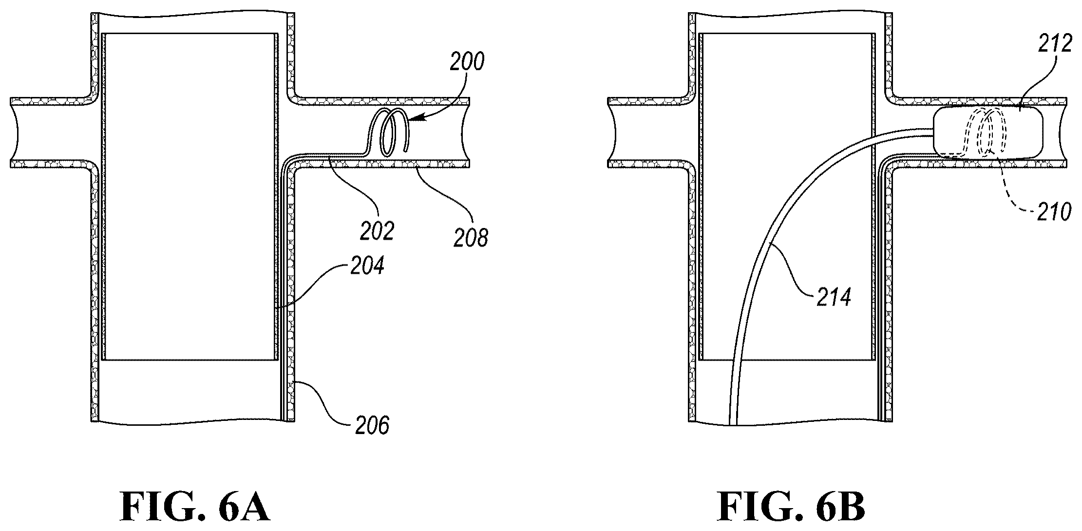 Patent US12426910 Figure 7 – In-situ fenestration devices with ultrasonic cutter