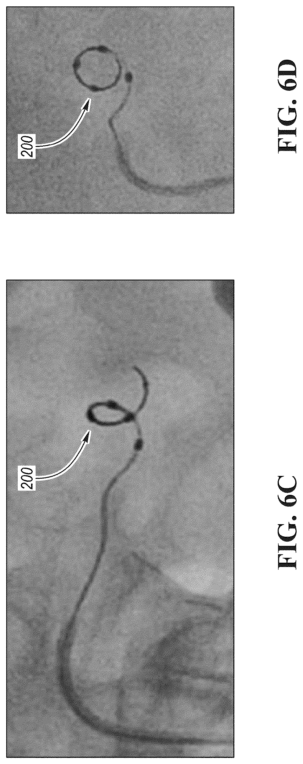 Patent US12426910 Figure 8 – In-situ fenestration devices with ultrasonic cutter