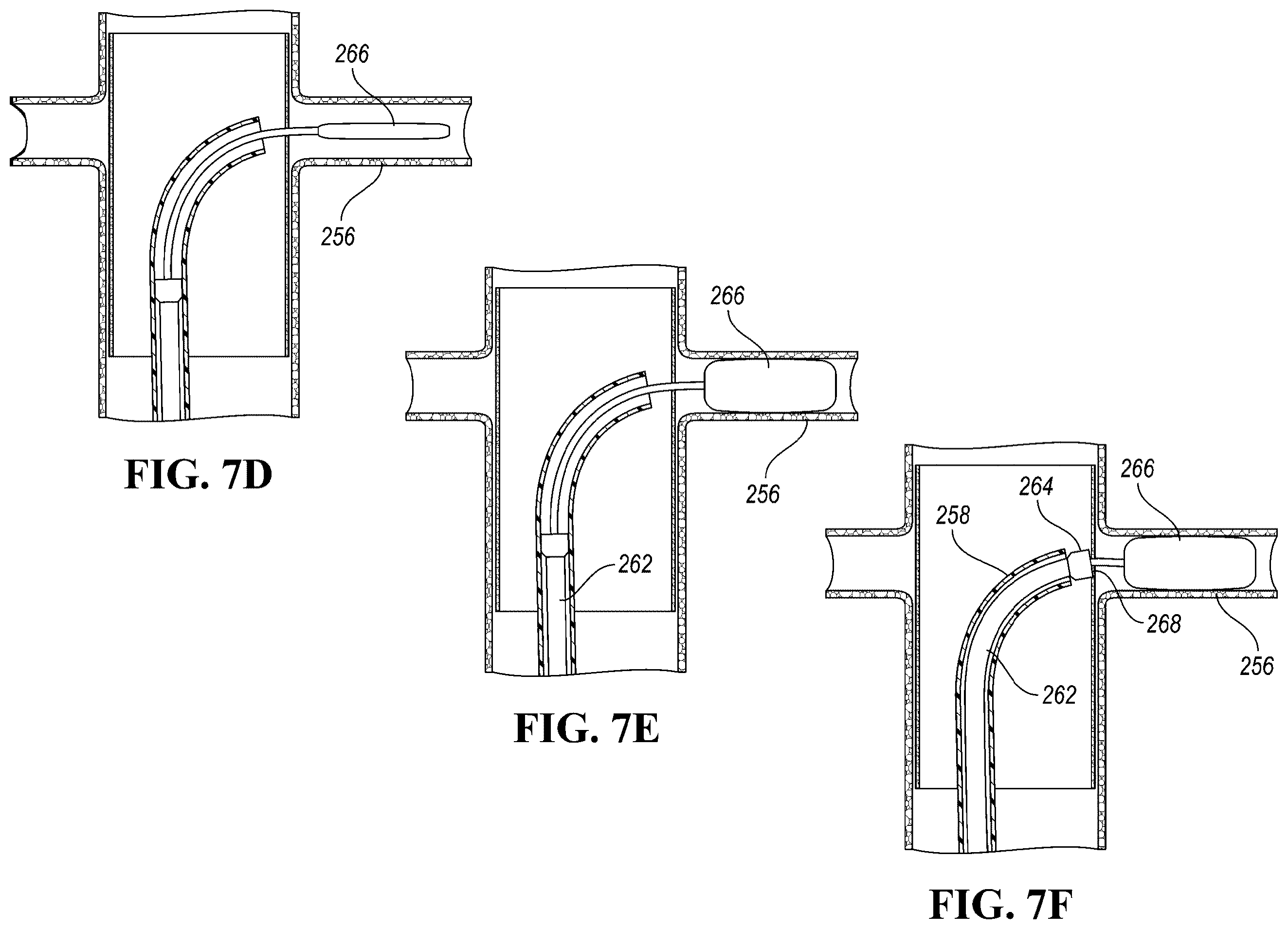 Patent US12426910 Figure 10 – In-situ fenestration devices with ultrasonic cutter