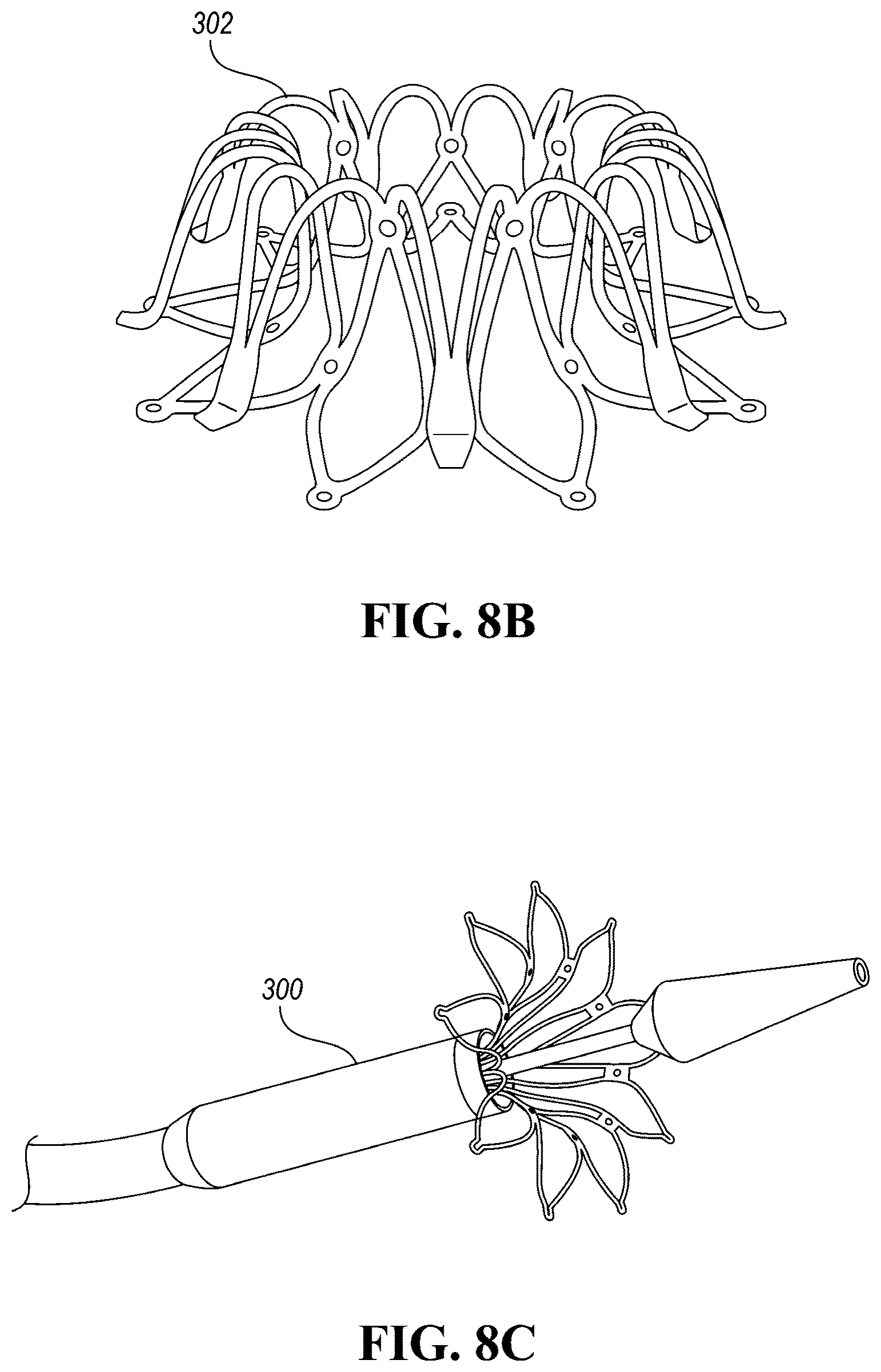 Patent US12426910 Figure 14 – In-situ fenestration devices with ultrasonic cutter