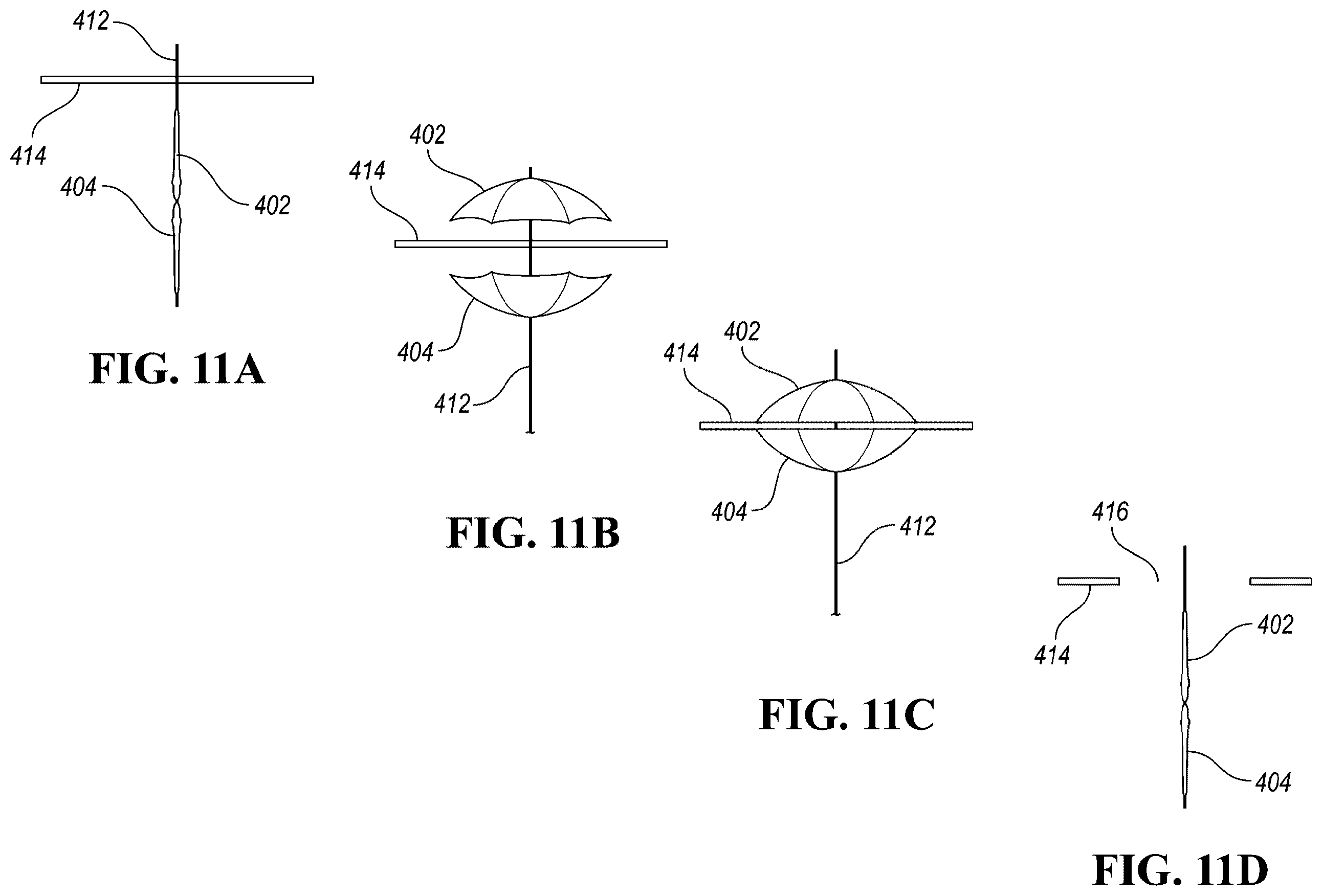 Patent US12426910 Figure 17 – In-situ fenestration devices with ultrasonic cutter
