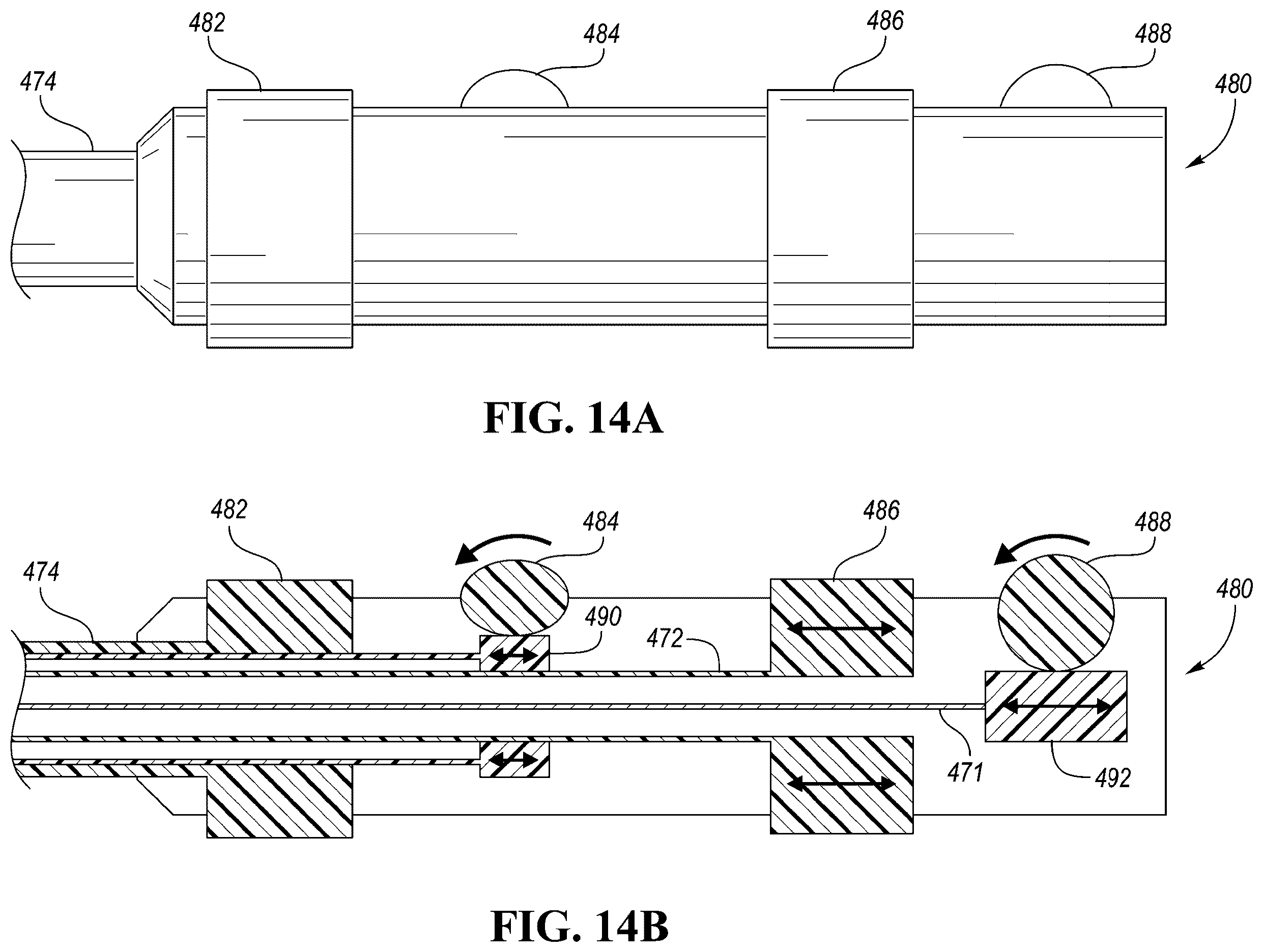 Patent US12426910 Figure 20 – In-situ fenestration devices with ultrasonic cutter