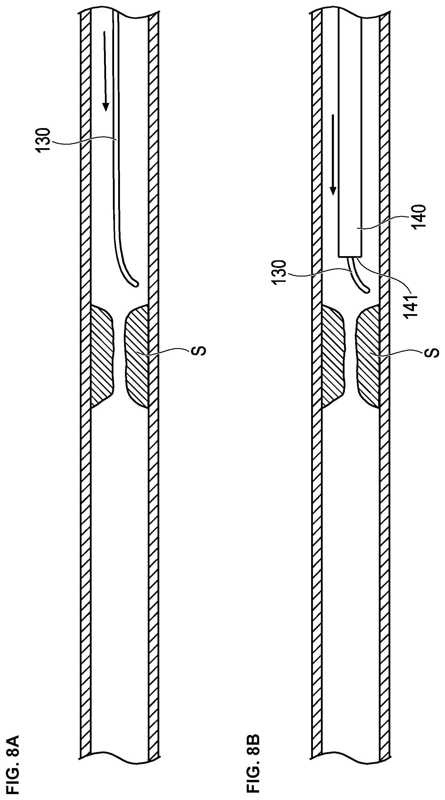 Patent US12426914 Figure 7 – Medical device and treatment method