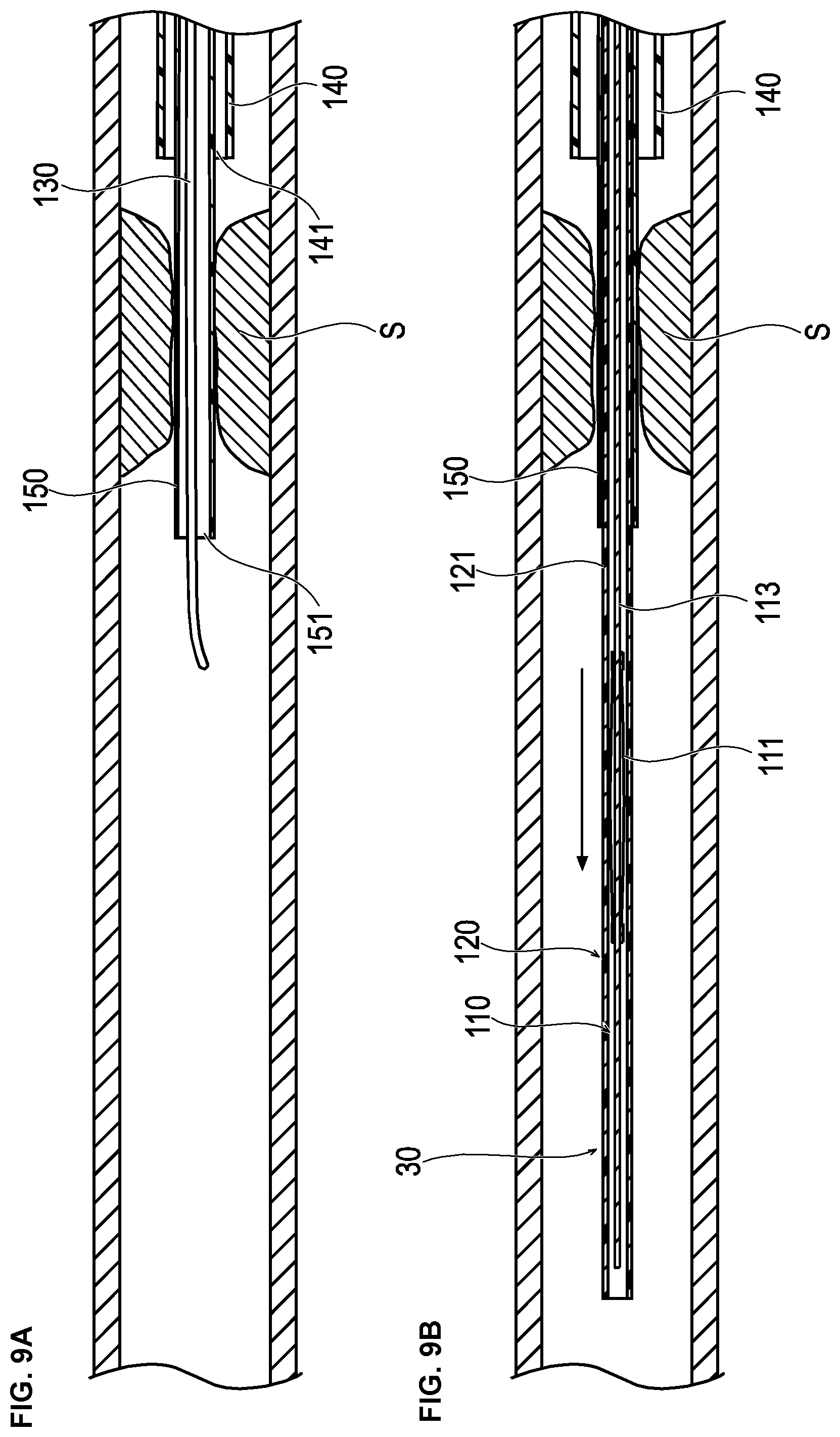 Patent US12426914 Figure 8 – Medical device and treatment method