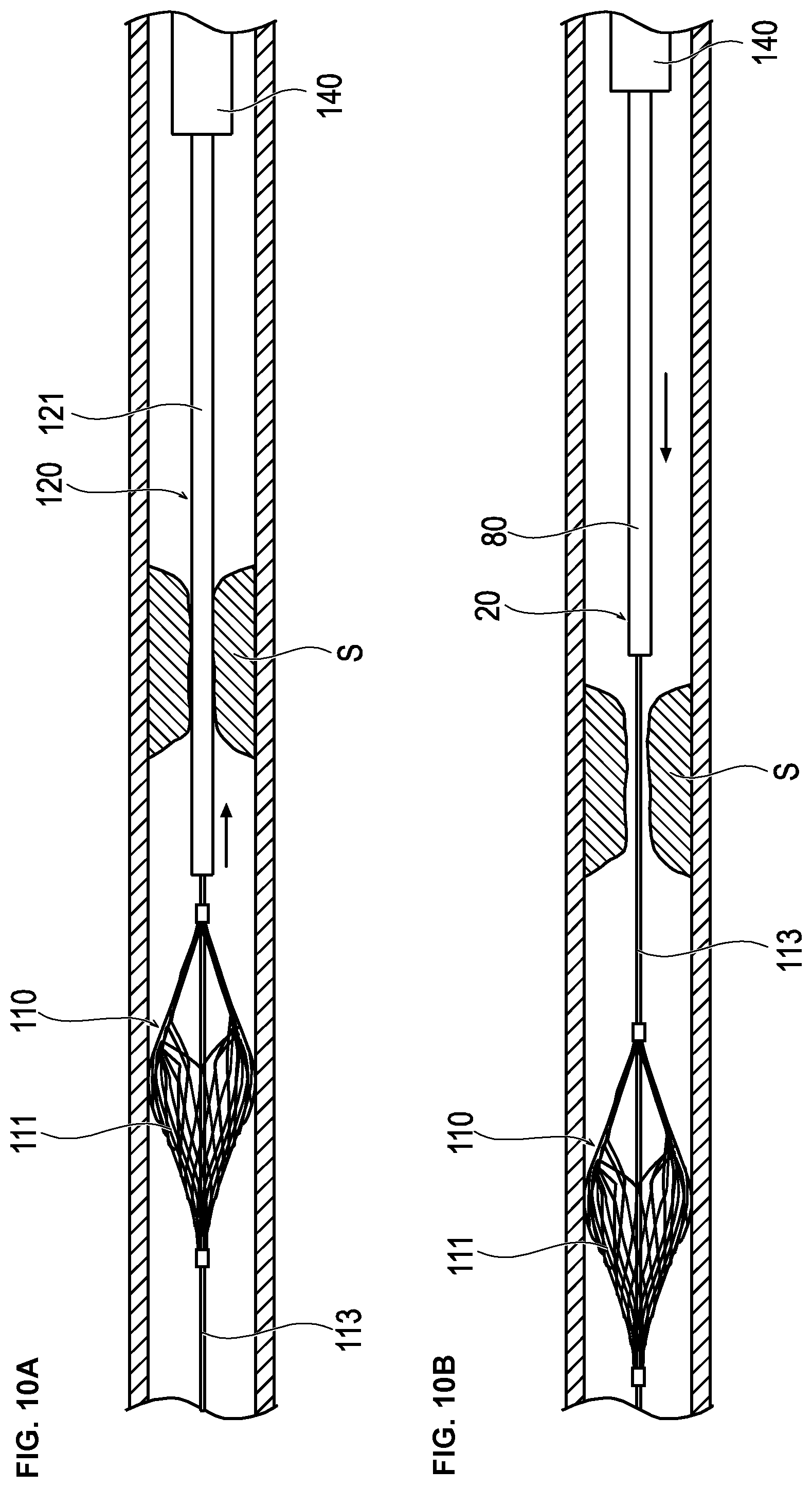 Patent US12426914 Figure 9 – Medical device and treatment method