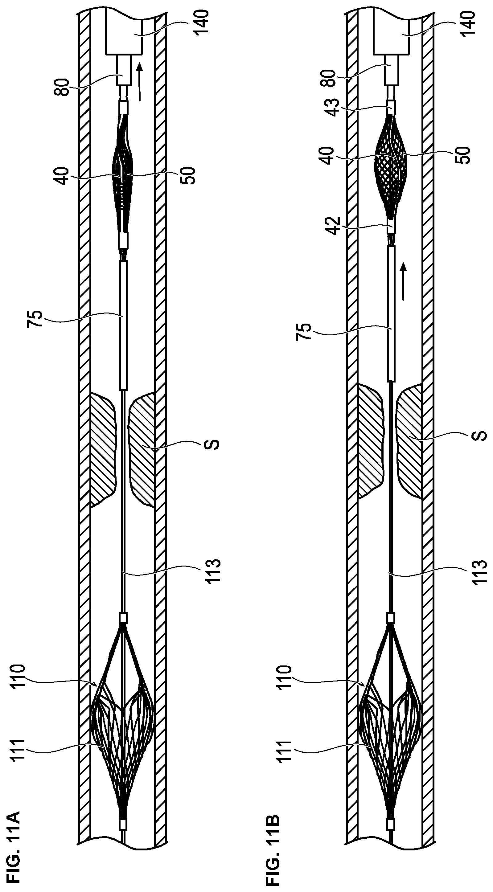 Patent US12426914 Figure 10 – Medical device and treatment method