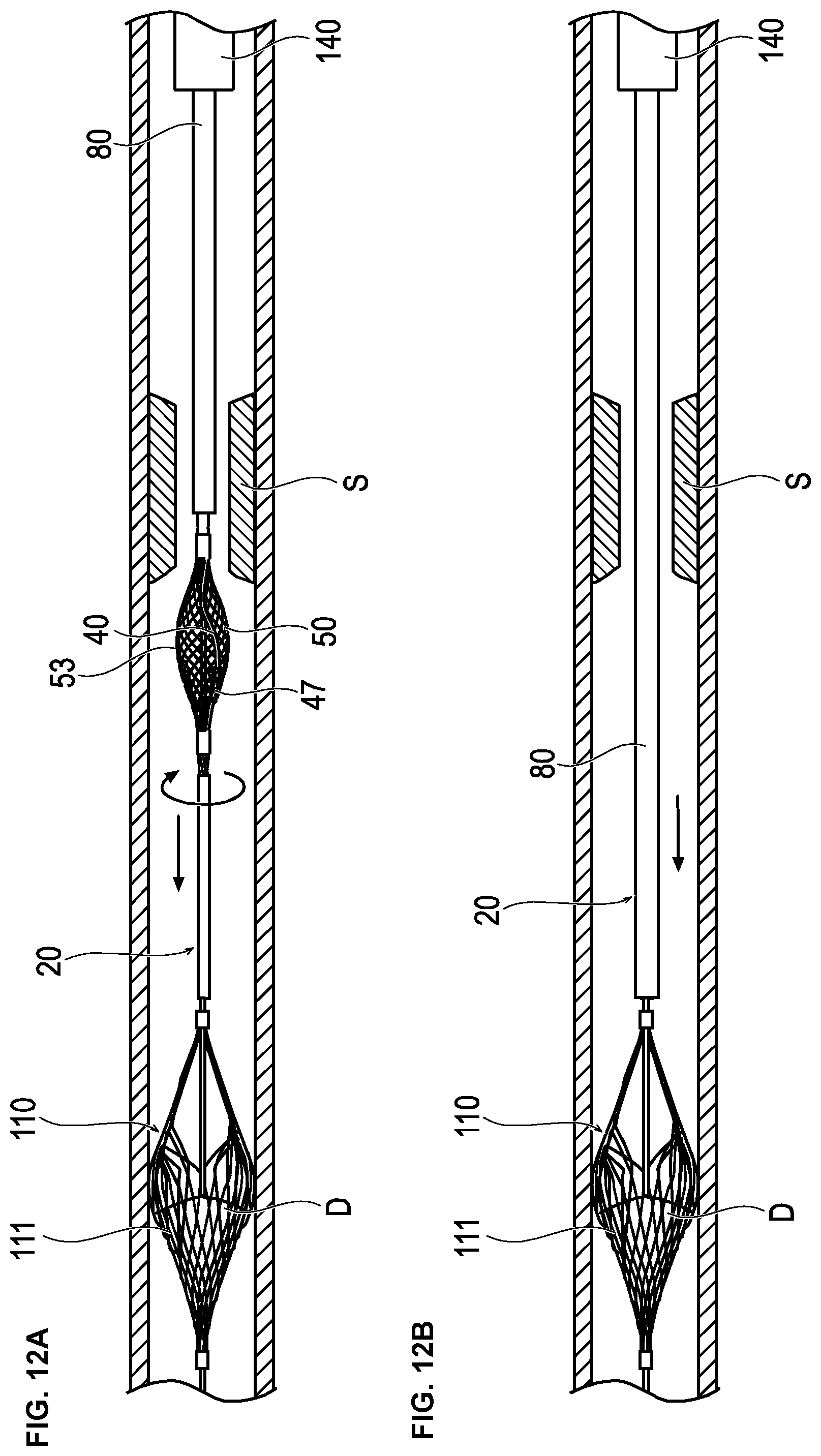 Patent US12426914 Figure 11 – Medical device and treatment method