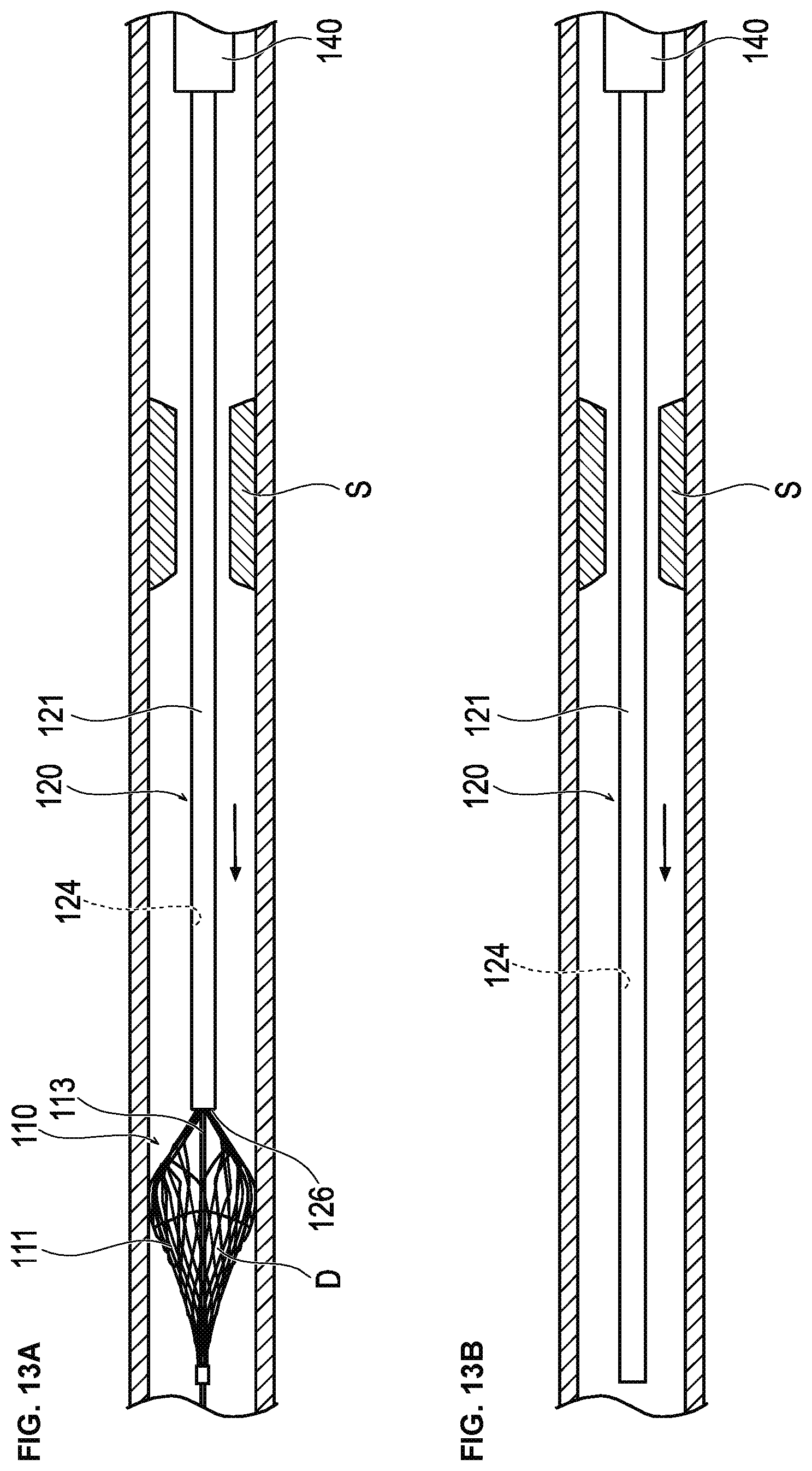Patent US12426914 Figure 12 – Medical device and treatment method
