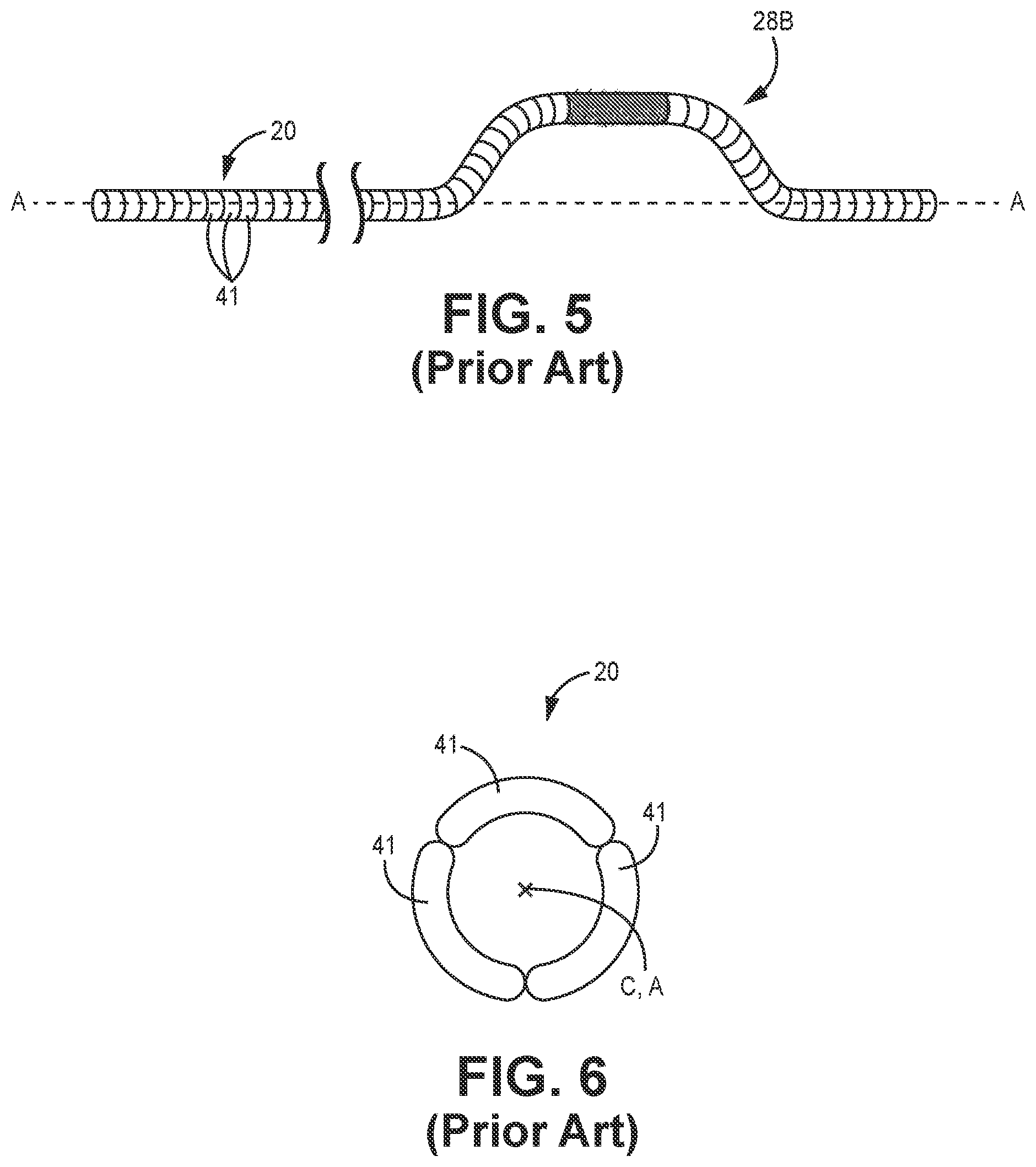Patent US12426915 Figure 3 – Devices and methods for generating orbital motion in drive shafts for rotational medical devices