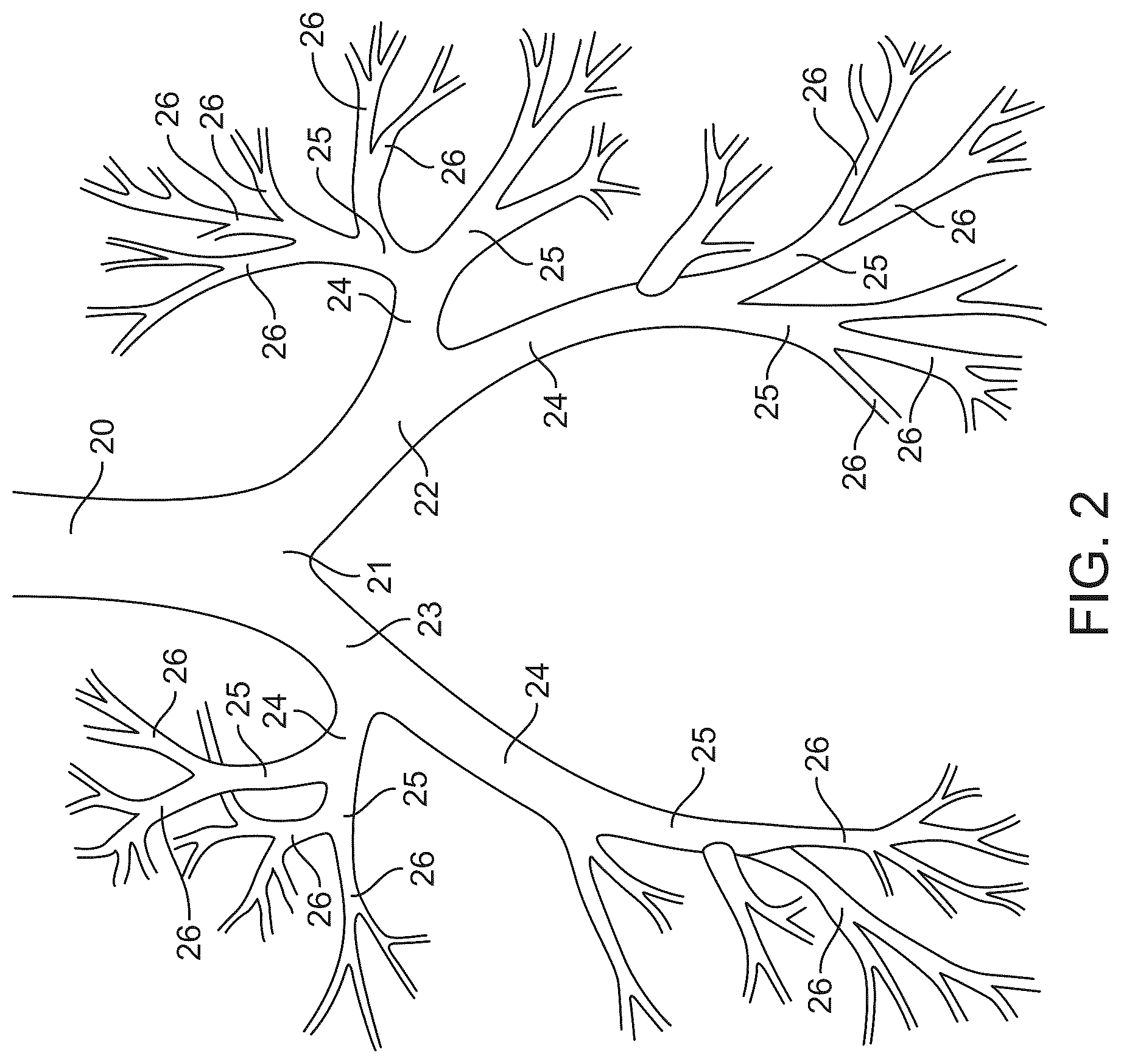 Patent US12426916 Figure 2 – Devices, methods, and systems to treat chronic bronchitis
