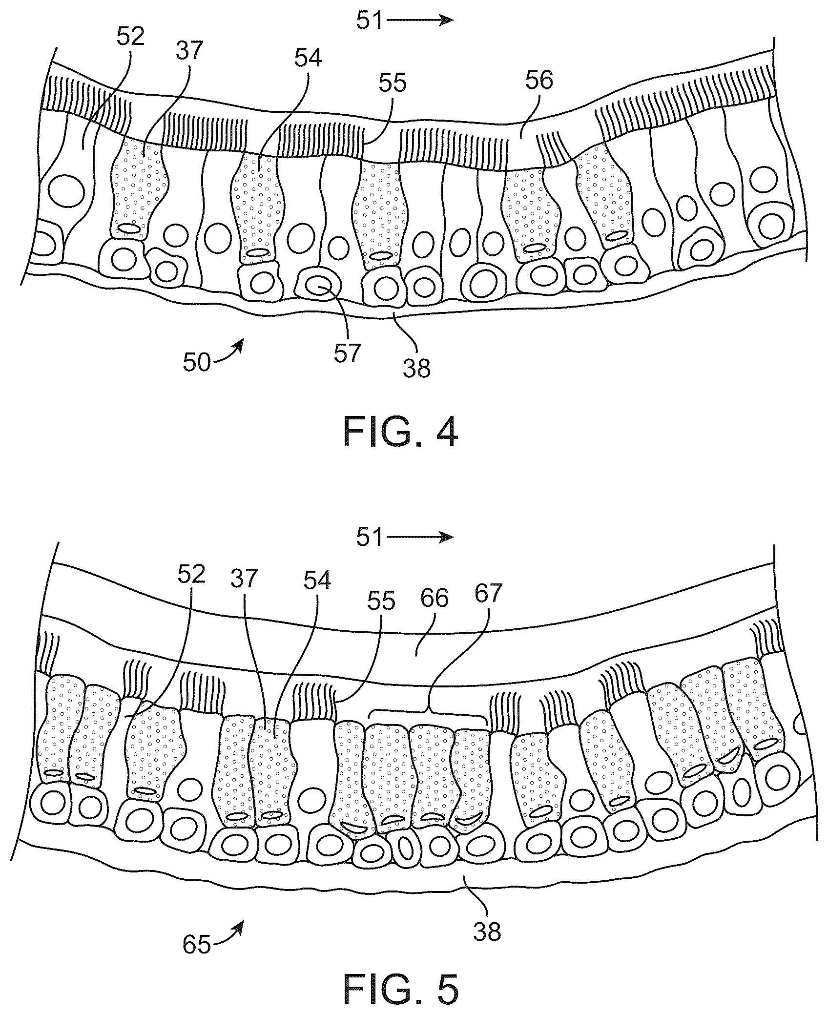 Patent US12426916 Figure 4 – Devices, methods, and systems to treat chronic bronchitis