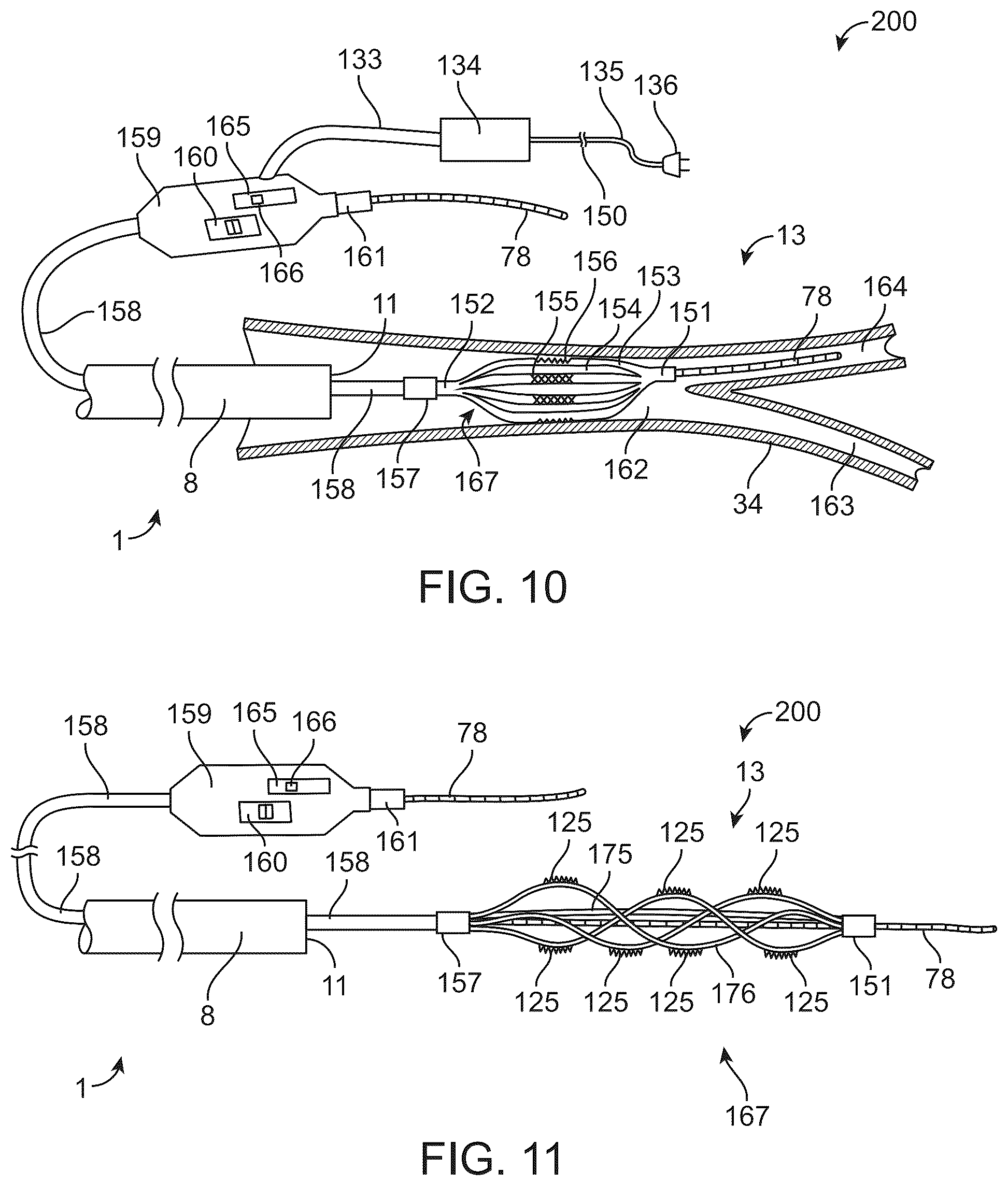 Patent US12426916 Figure 10 – Devices, methods, and systems to treat chronic bronchitis