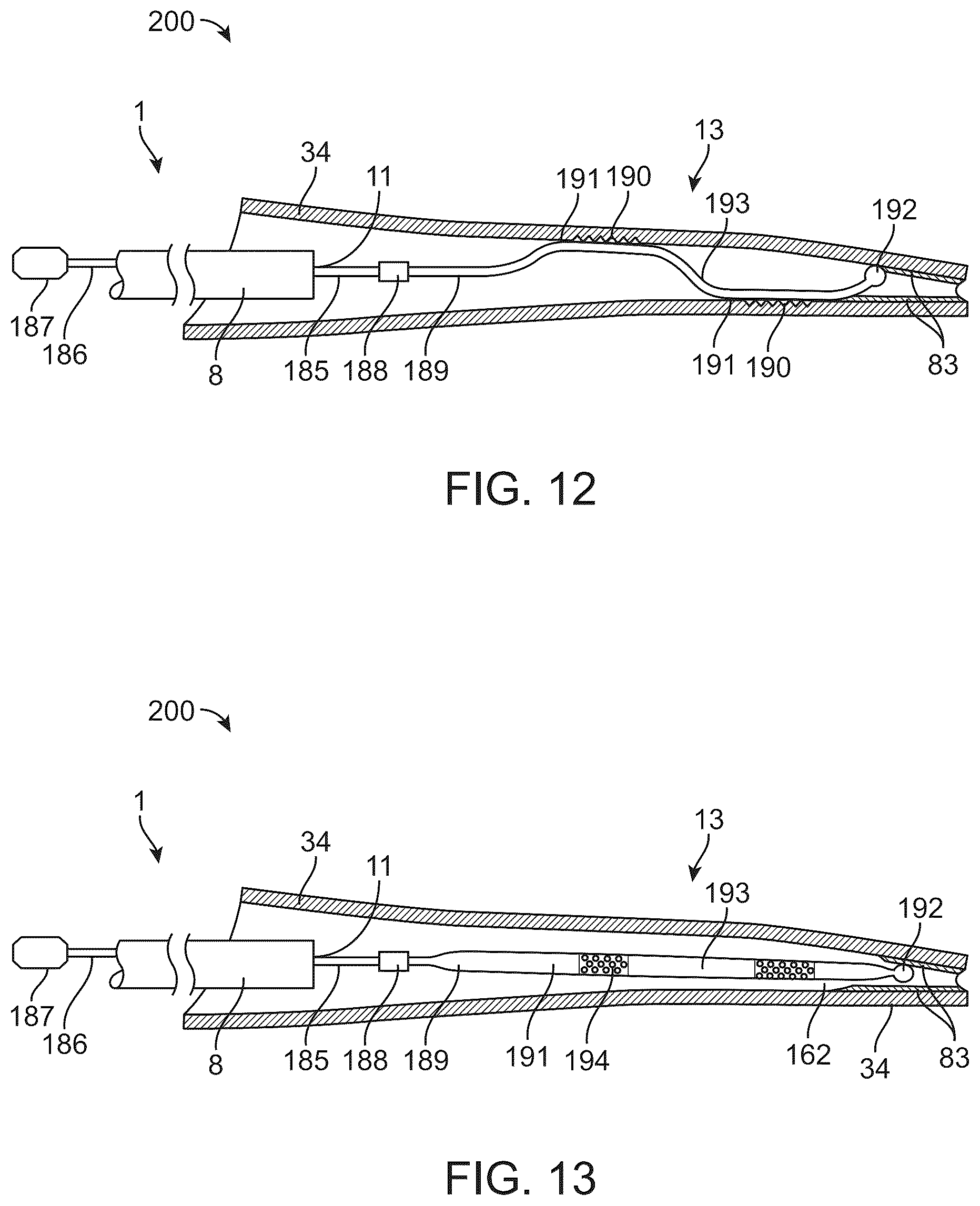 Patent US12426916 Figure 11 – Devices, methods, and systems to treat chronic bronchitis