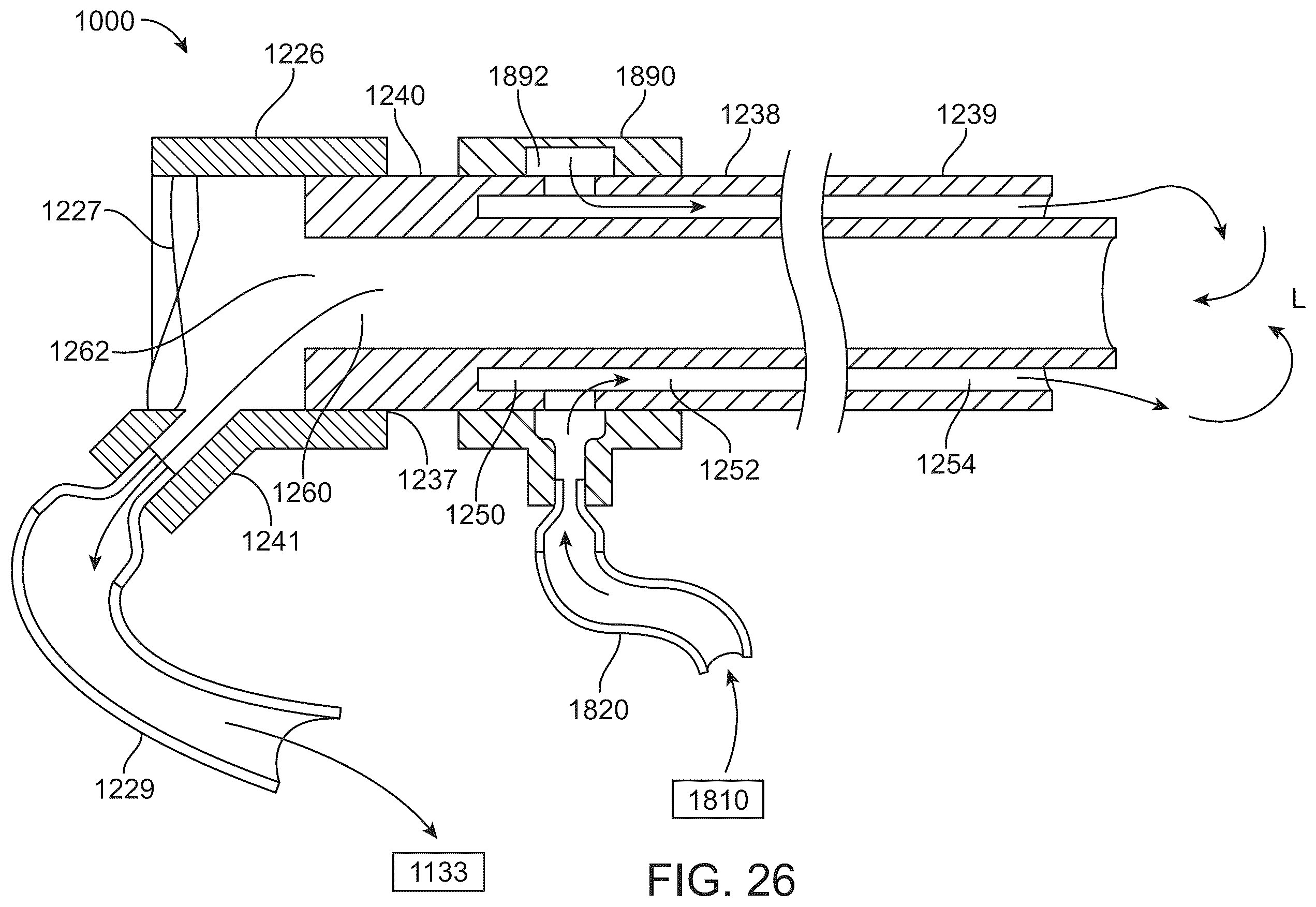 Patent US12426916 Figure 19 – Devices, methods, and systems to treat chronic bronchitis