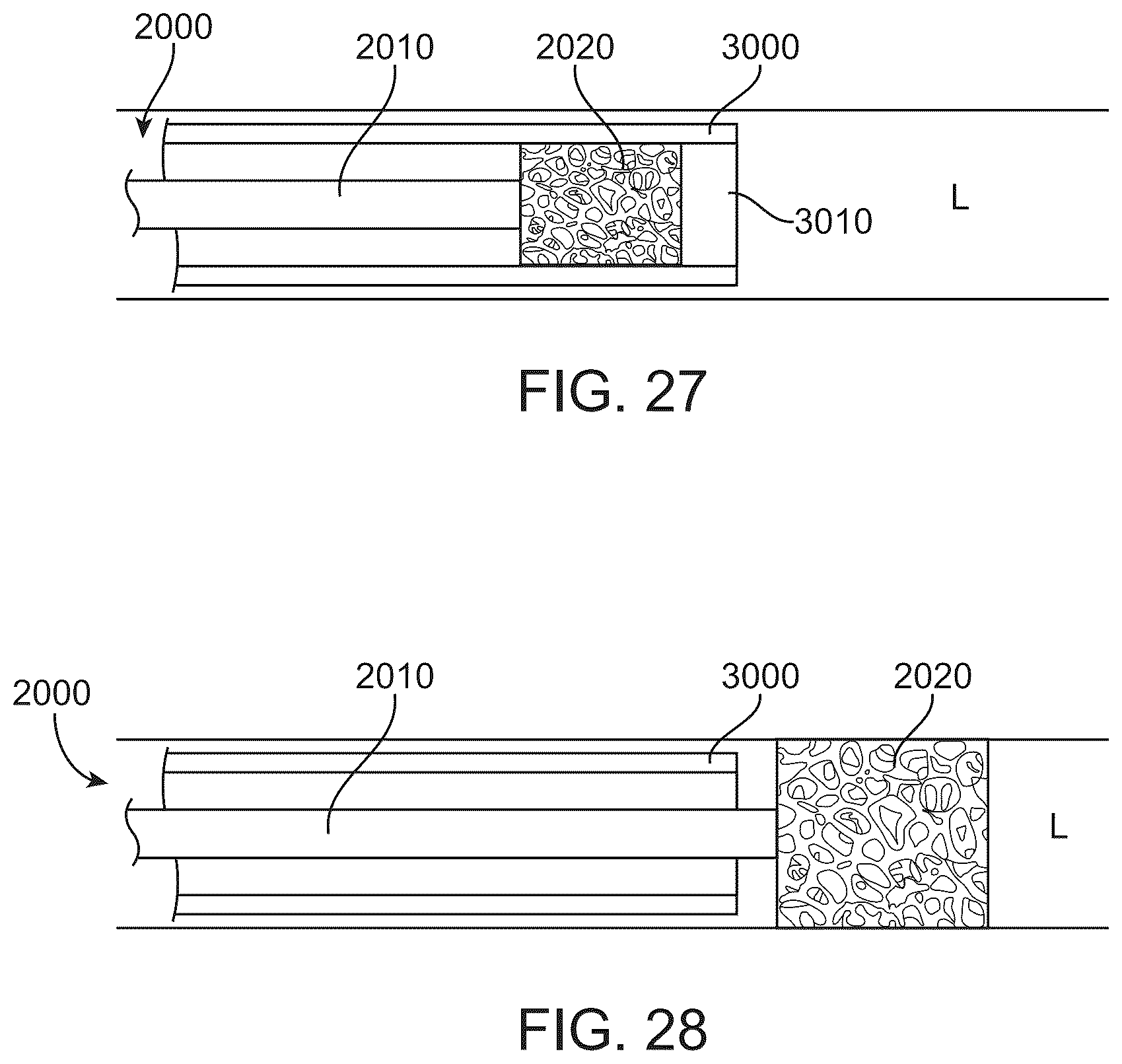 Patent US12426916 Figure 20 – Devices, methods, and systems to treat chronic bronchitis