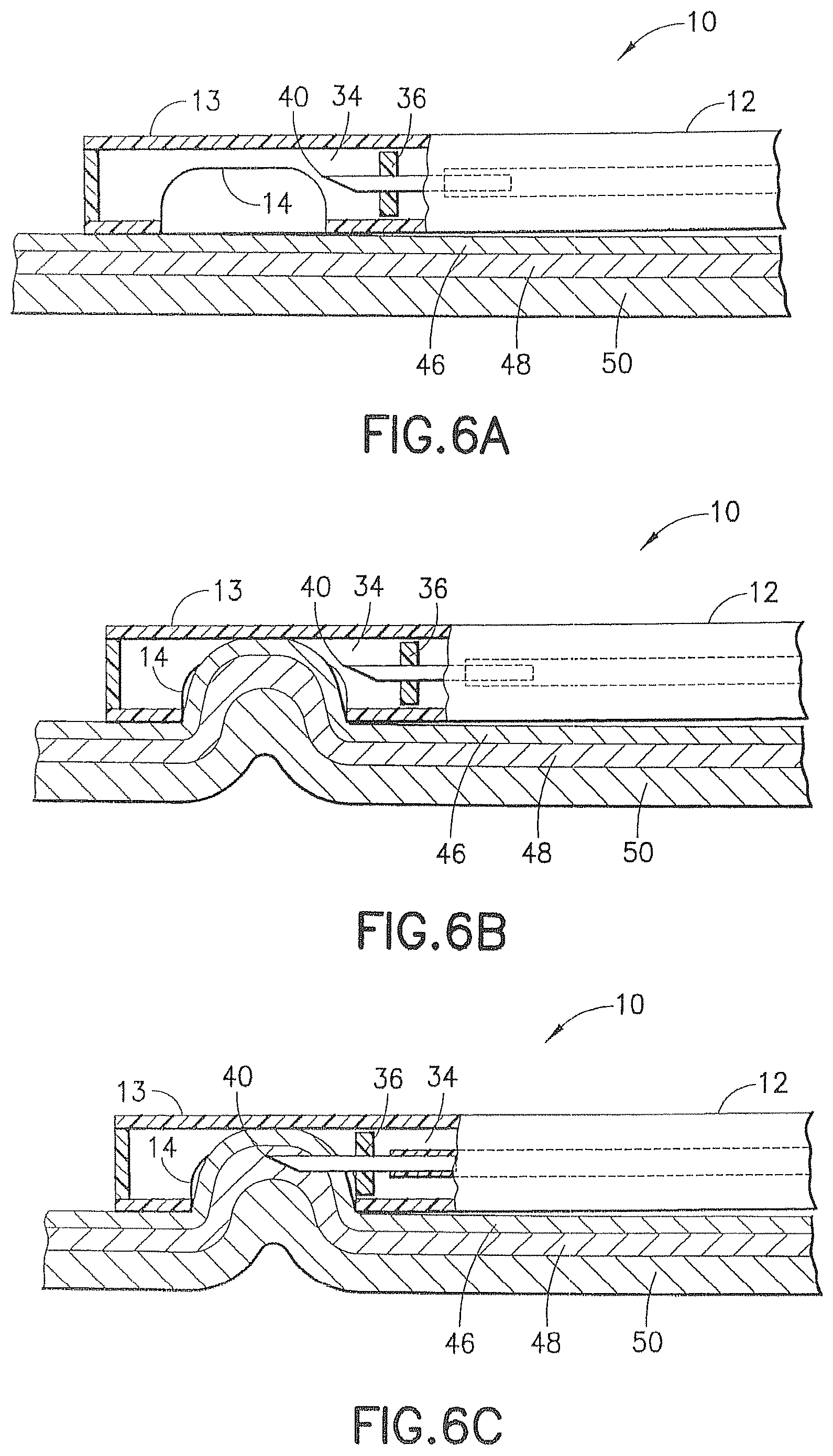 Patent US12426917 Figure 5 – Methods and systems for performing submucosal medical procedures