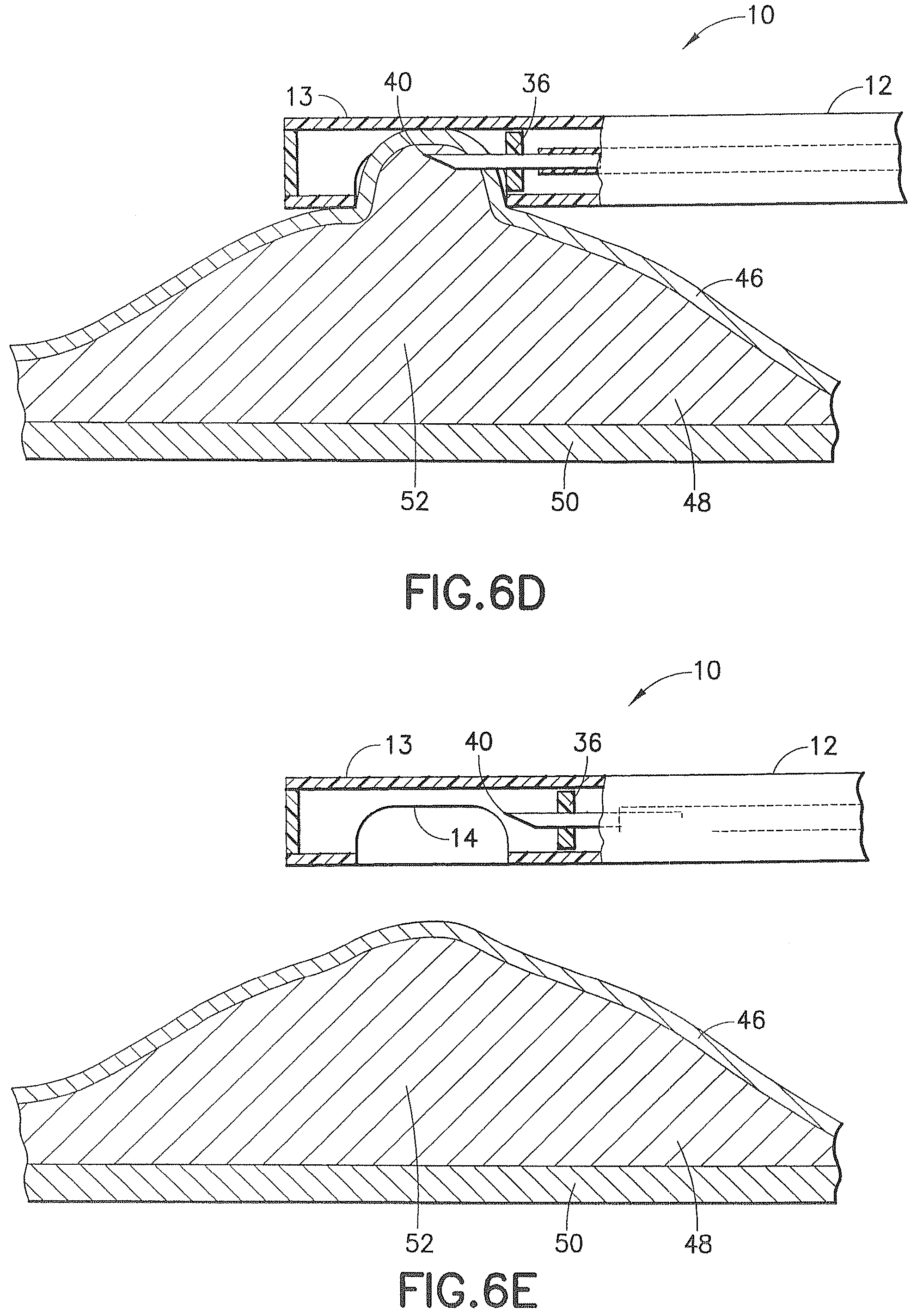 Patent US12426917 Figure 6 – Methods and systems for performing submucosal medical procedures