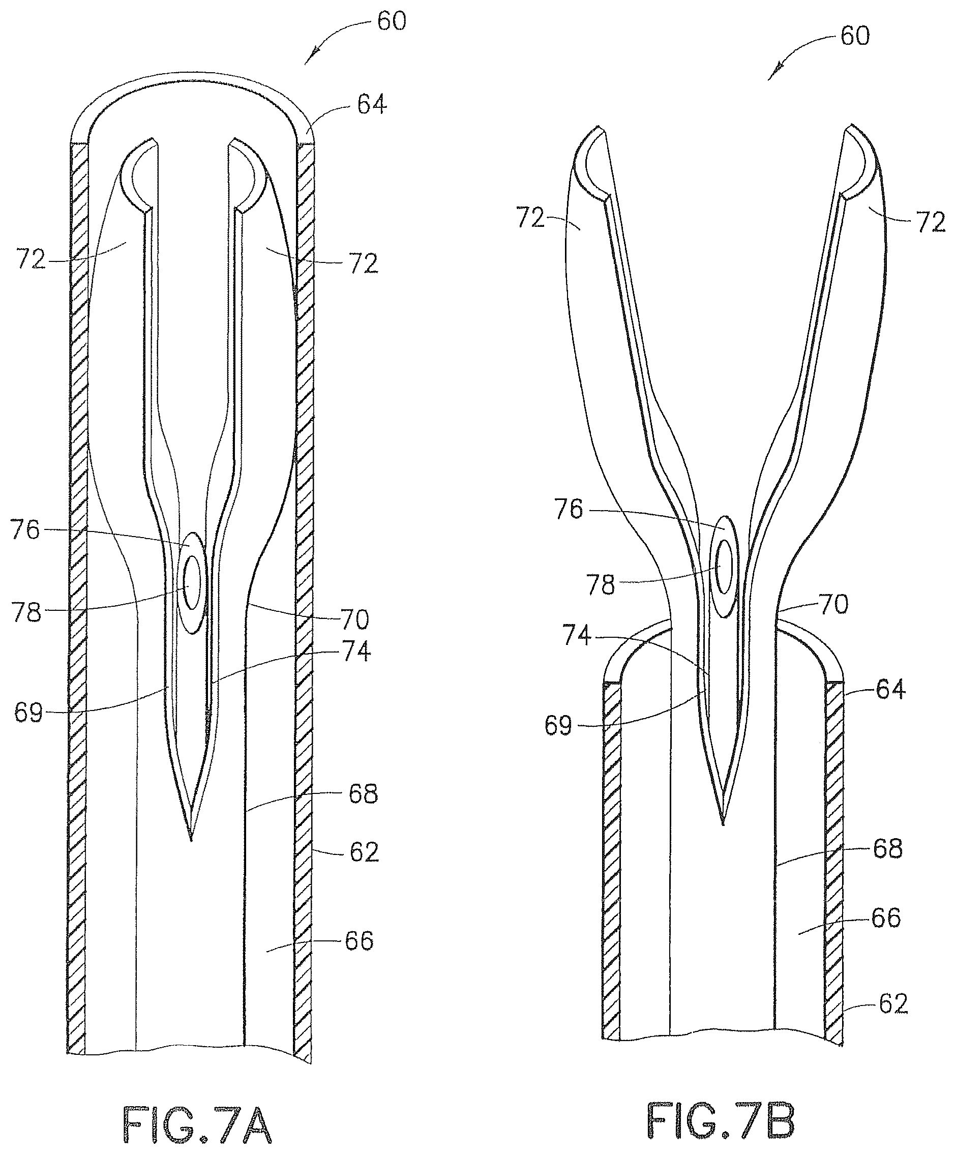 Patent US12426917 Figure 7 – Methods and systems for performing submucosal medical procedures