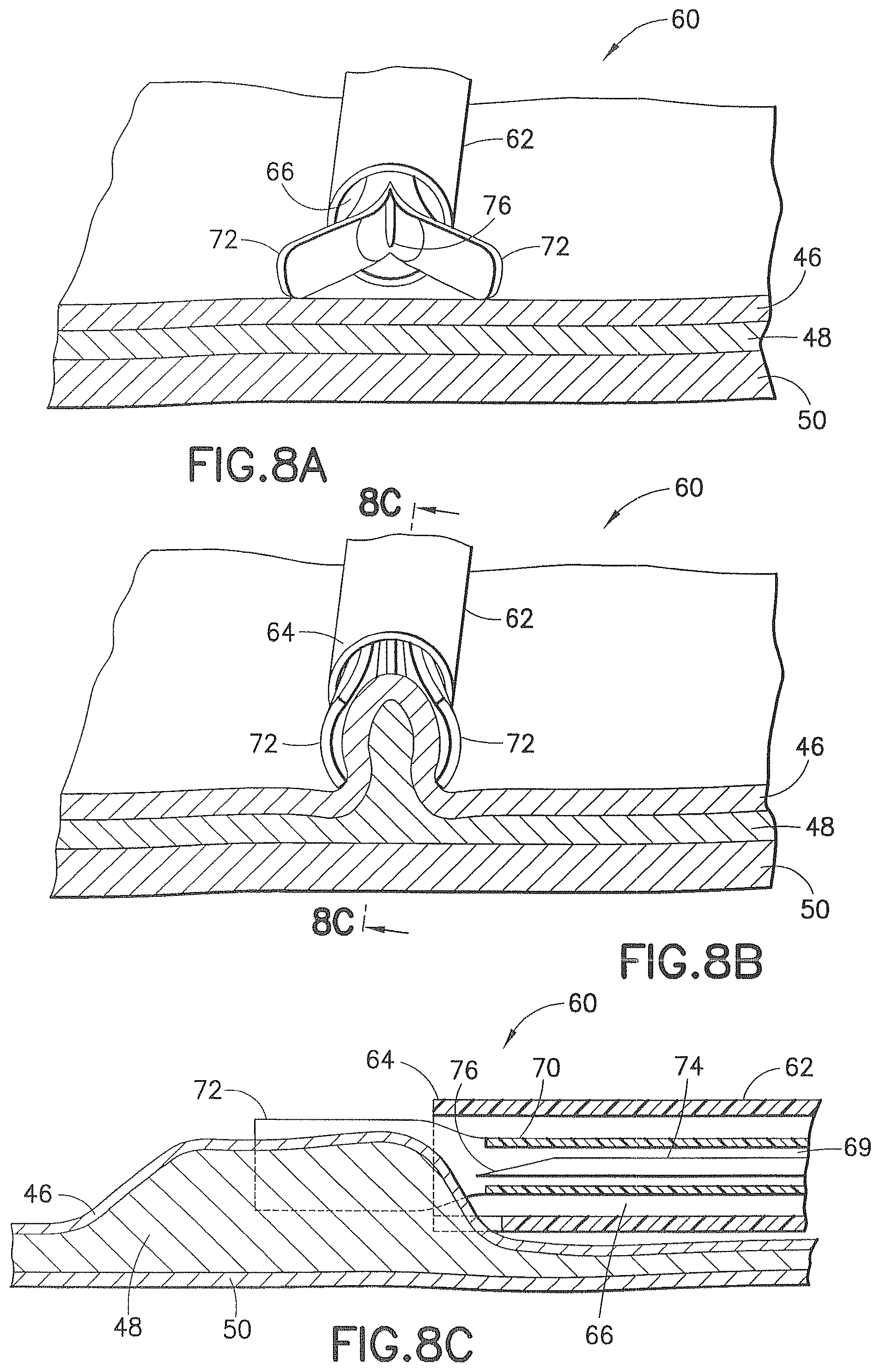 Patent US12426917 Figure 9 – Methods and systems for performing submucosal medical procedures