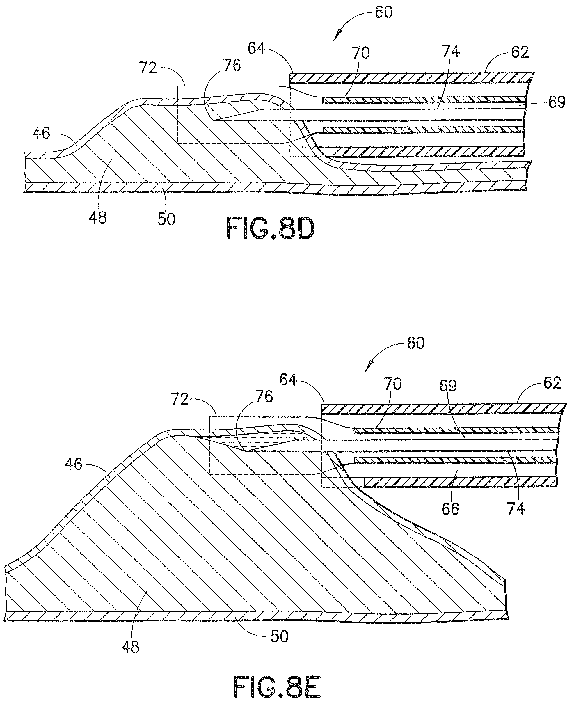 Patent US12426917 Figure 10 – Methods and systems for performing submucosal medical procedures
