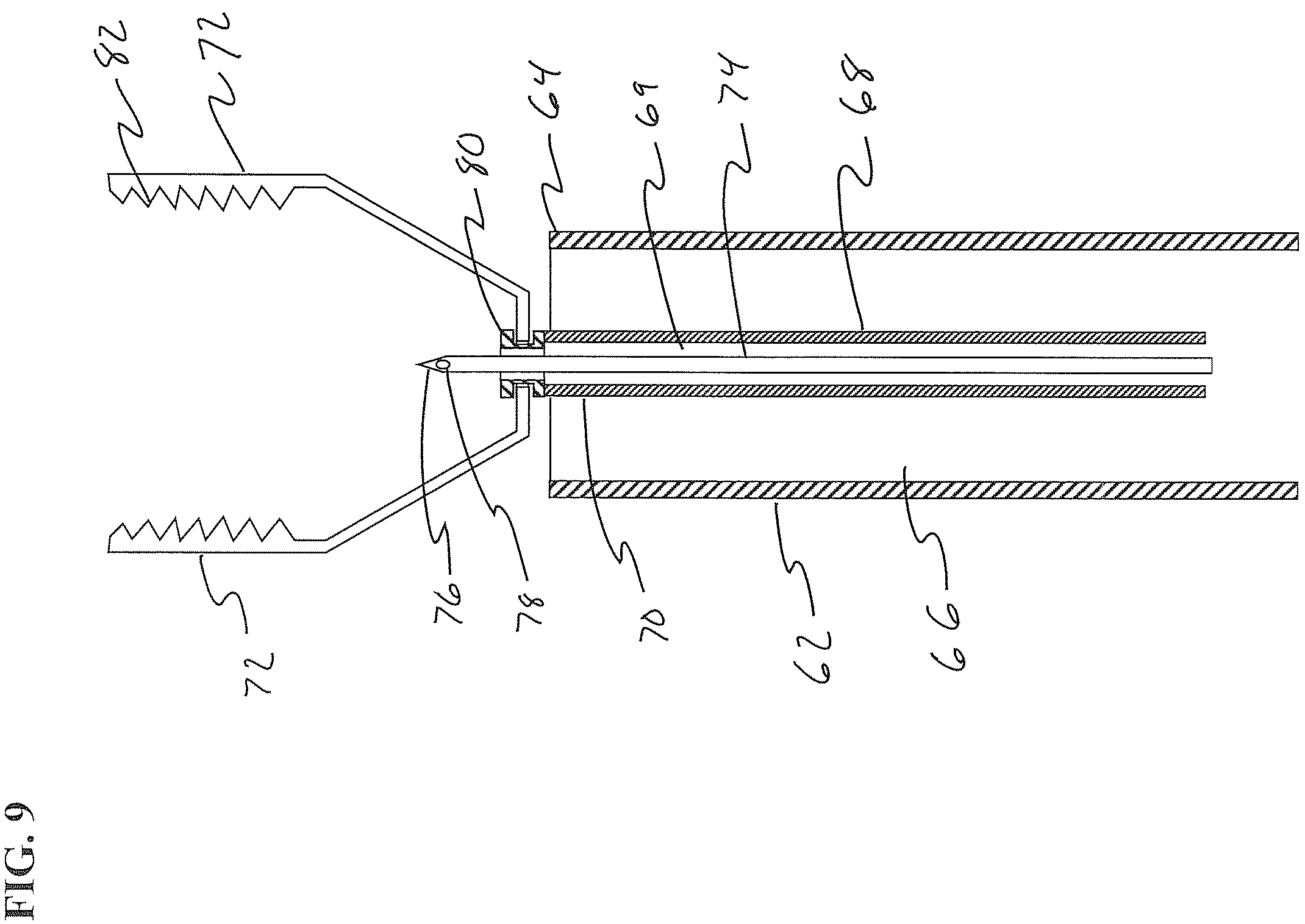 Patent US12426917 Figure 11 – Methods and systems for performing submucosal medical procedures