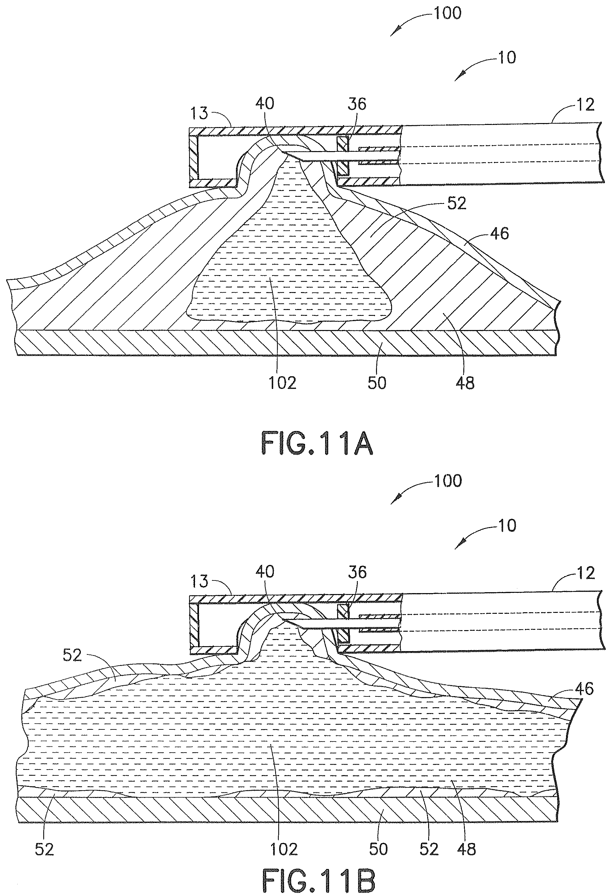 Patent US12426917 Figure 13 – Methods and systems for performing submucosal medical procedures