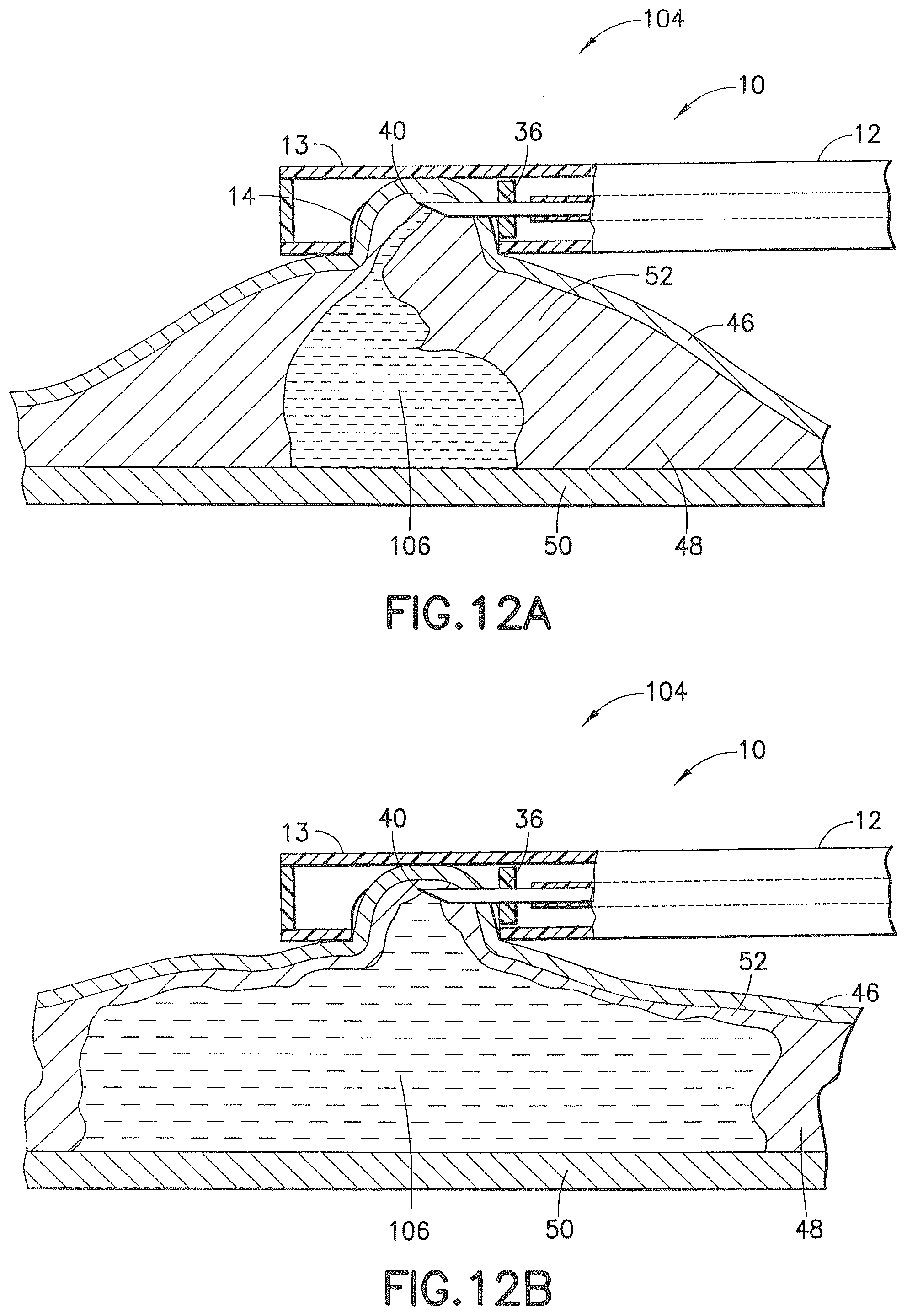 Patent US12426917 Figure 14 – Methods and systems for performing submucosal medical procedures