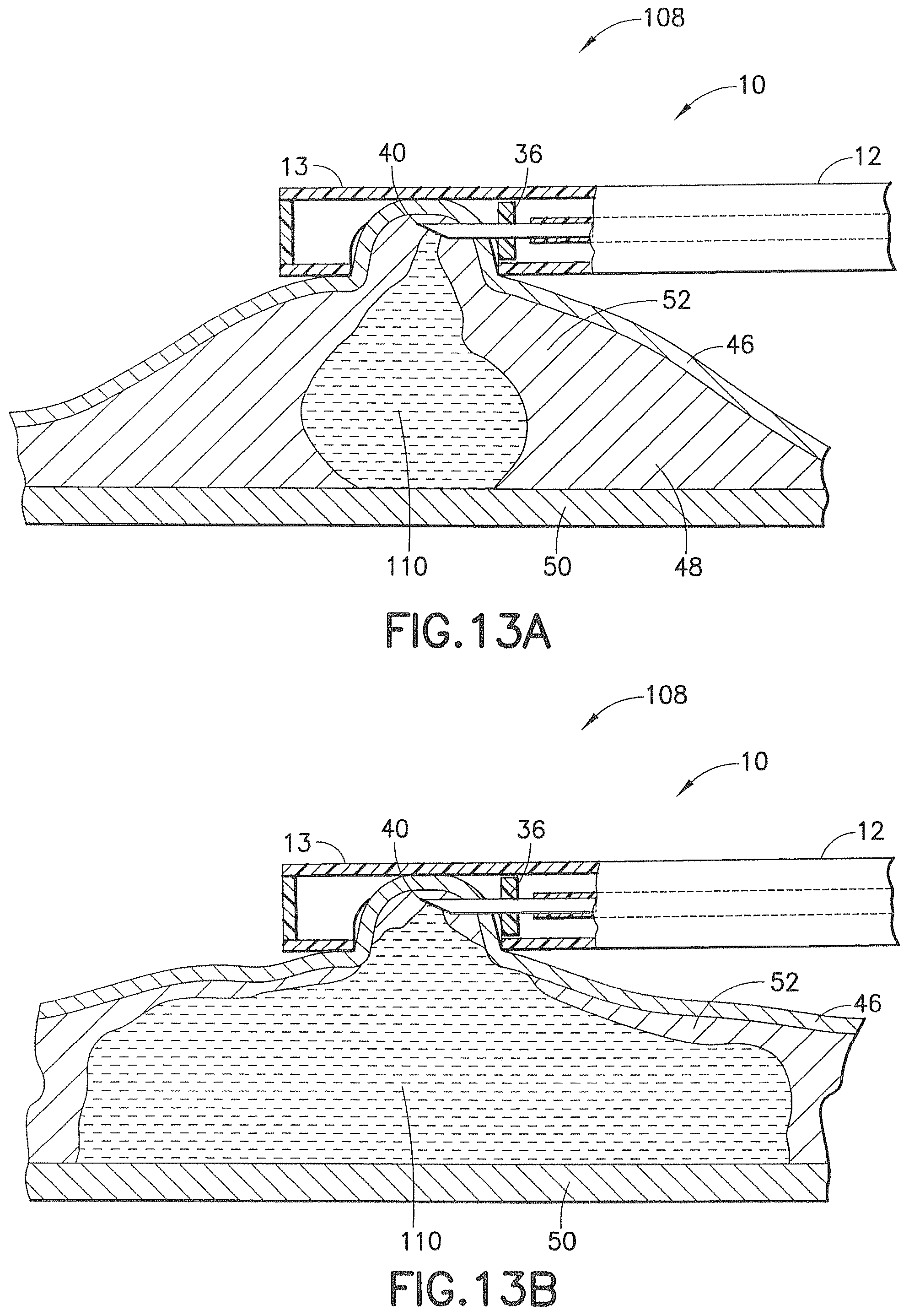 Patent US12426917 Figure 15 – Methods and systems for performing submucosal medical procedures