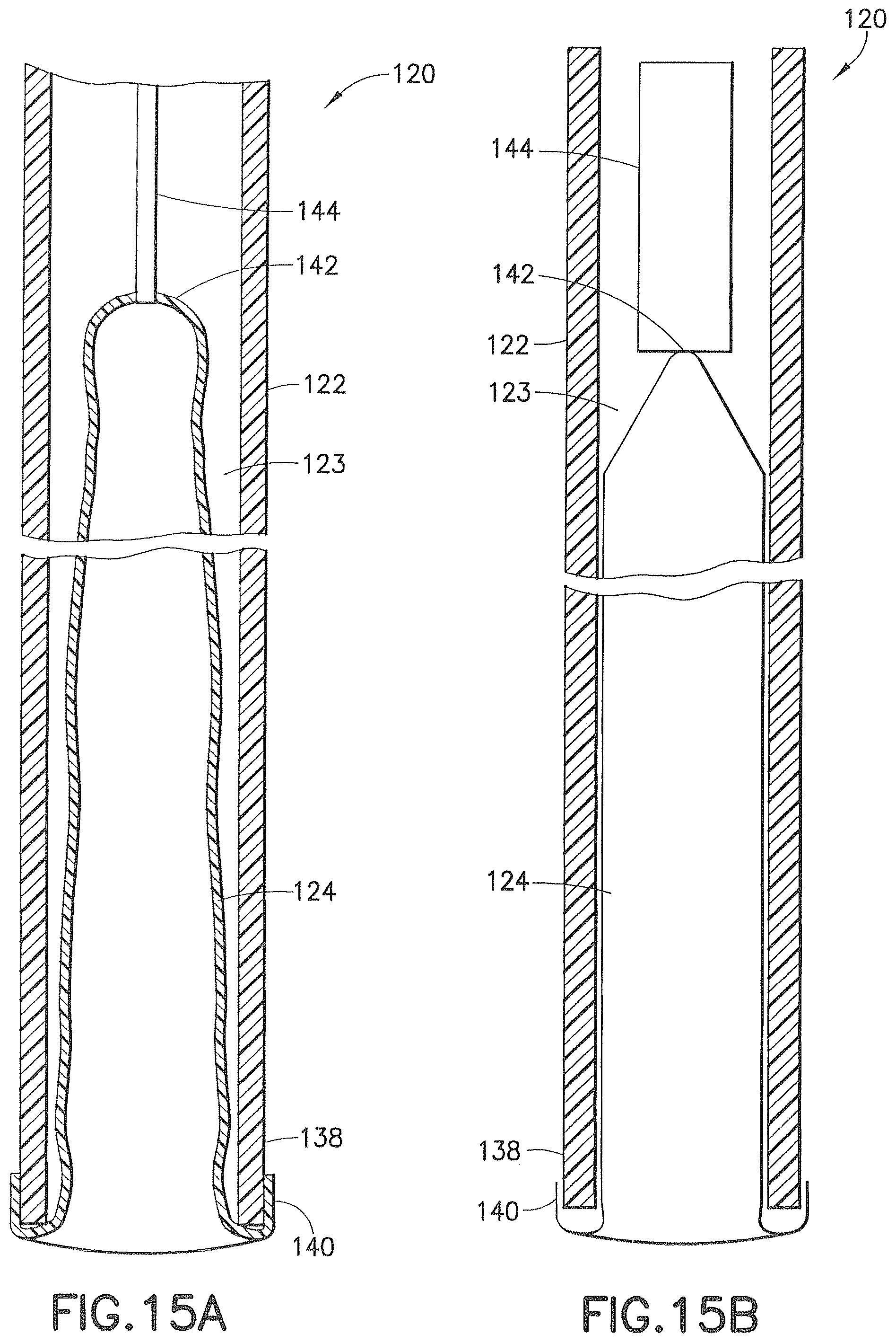 Patent US12426917 Figure 17 – Methods and systems for performing submucosal medical procedures
