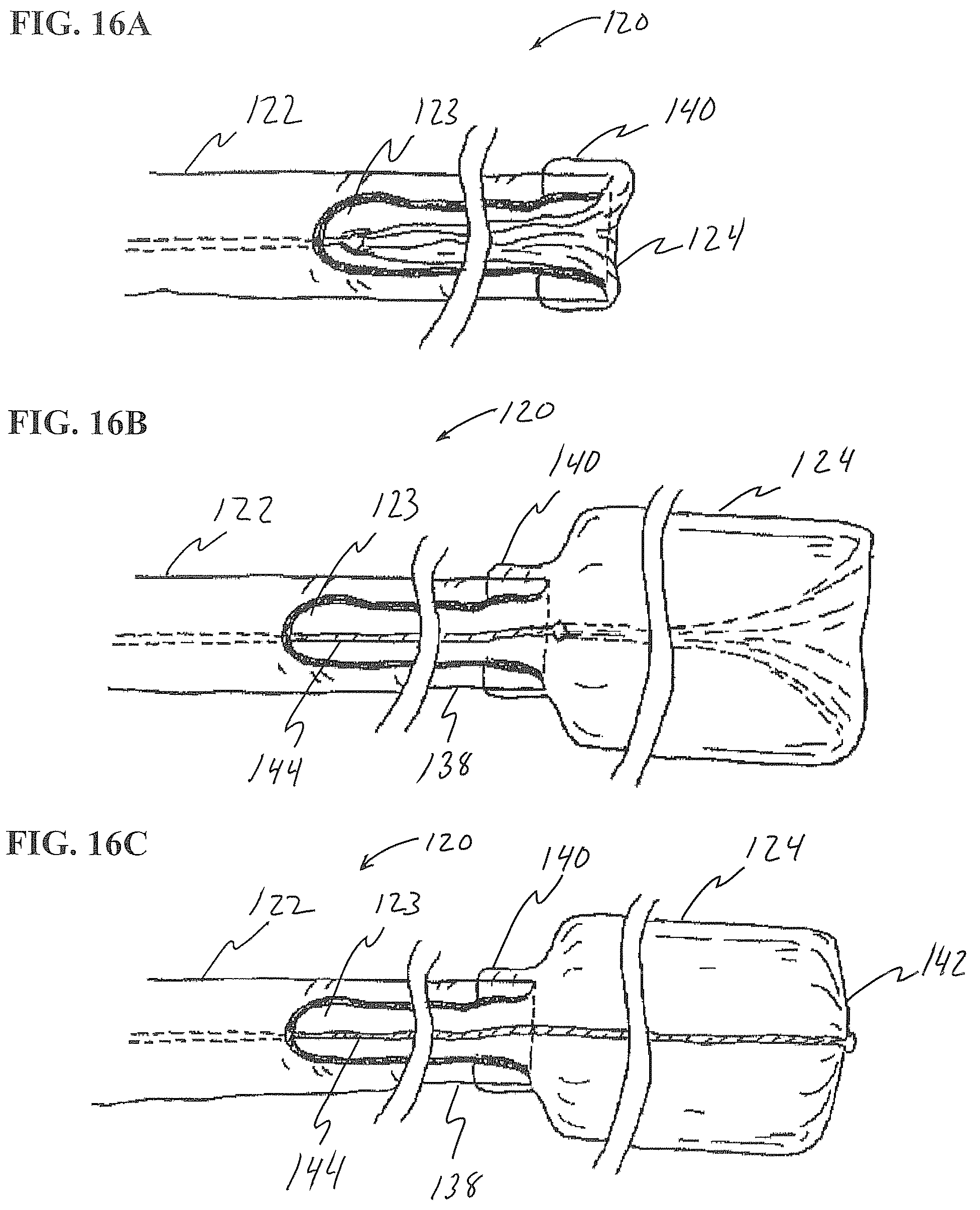 Patent US12426917 Figure 18 – Methods and systems for performing submucosal medical procedures