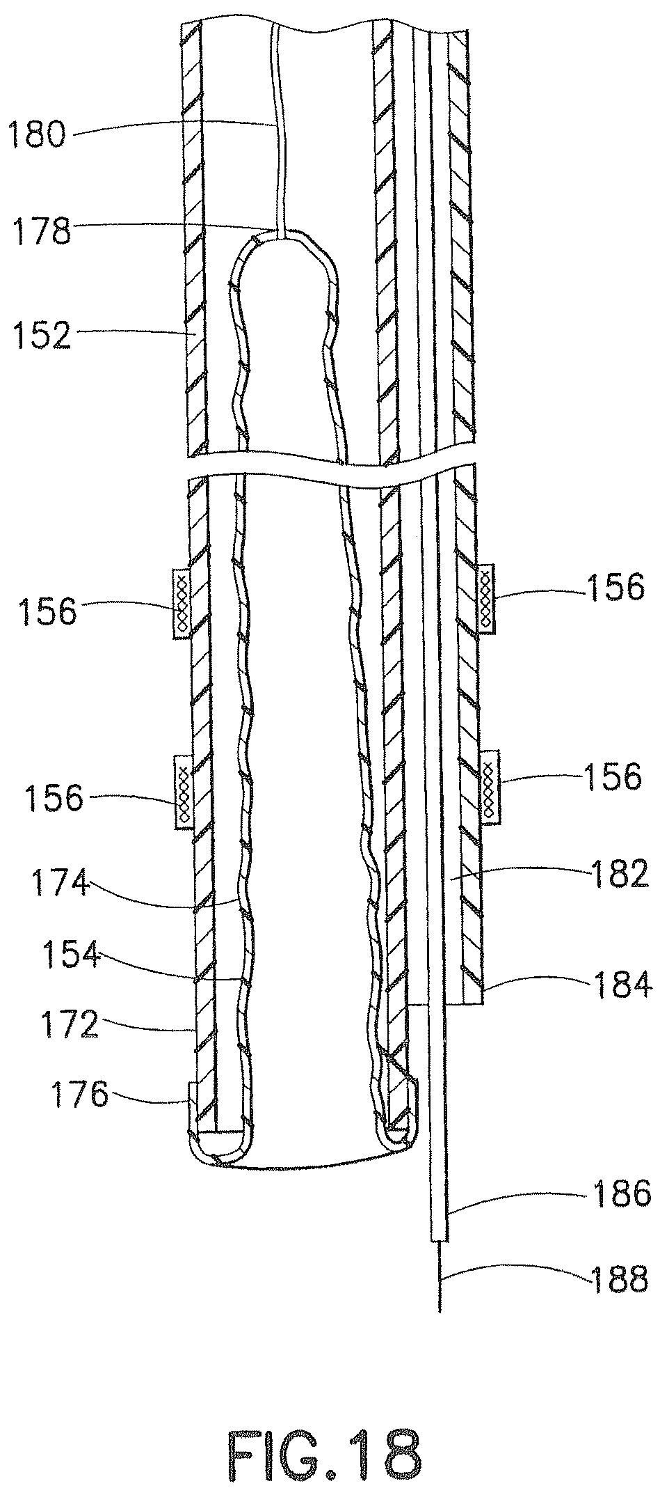 Patent US12426917 Figure 20 – Methods and systems for performing submucosal medical procedures