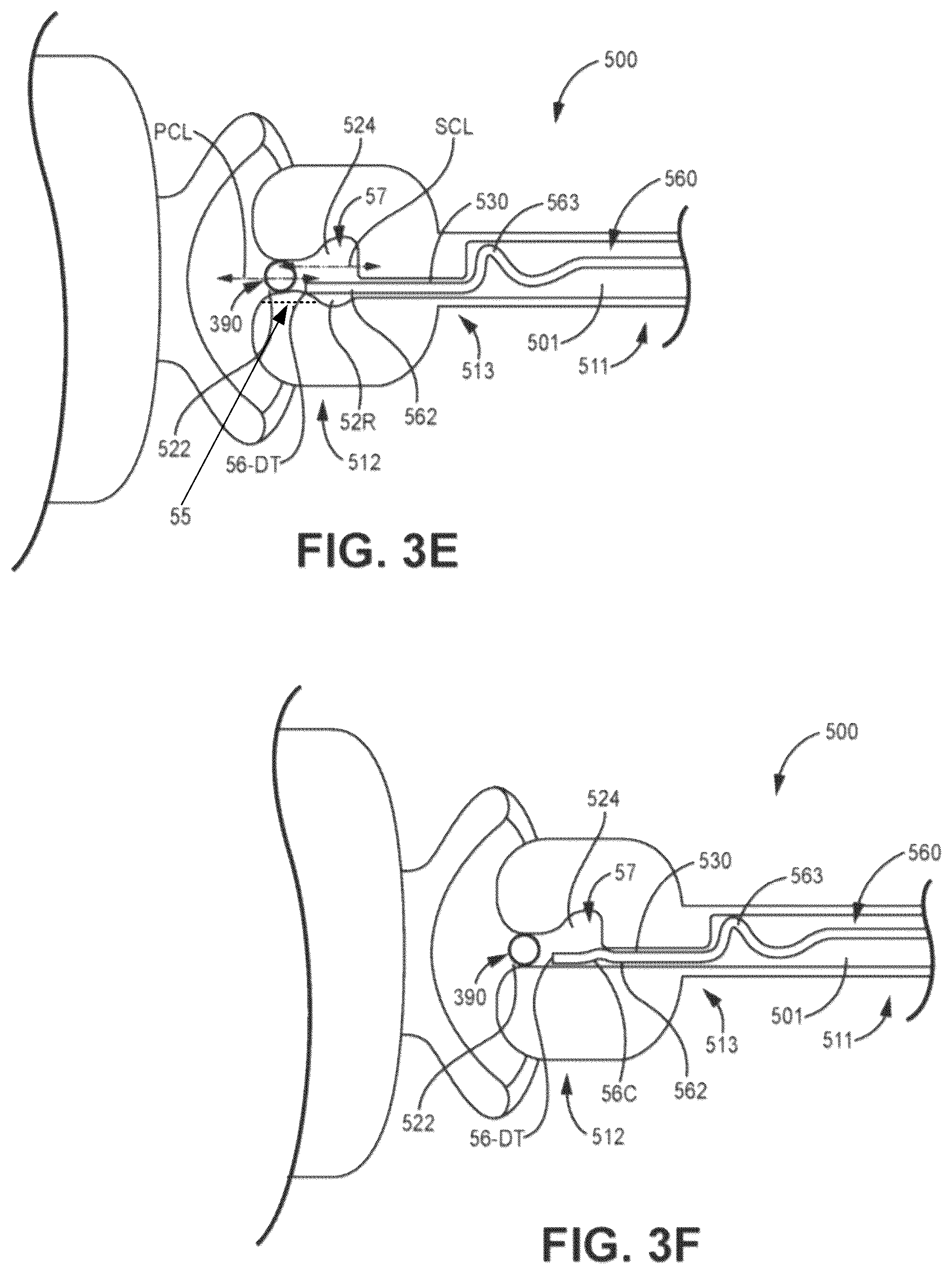 Patent US12426921 Figure 9 – Interventional medical systems and associated assemblies