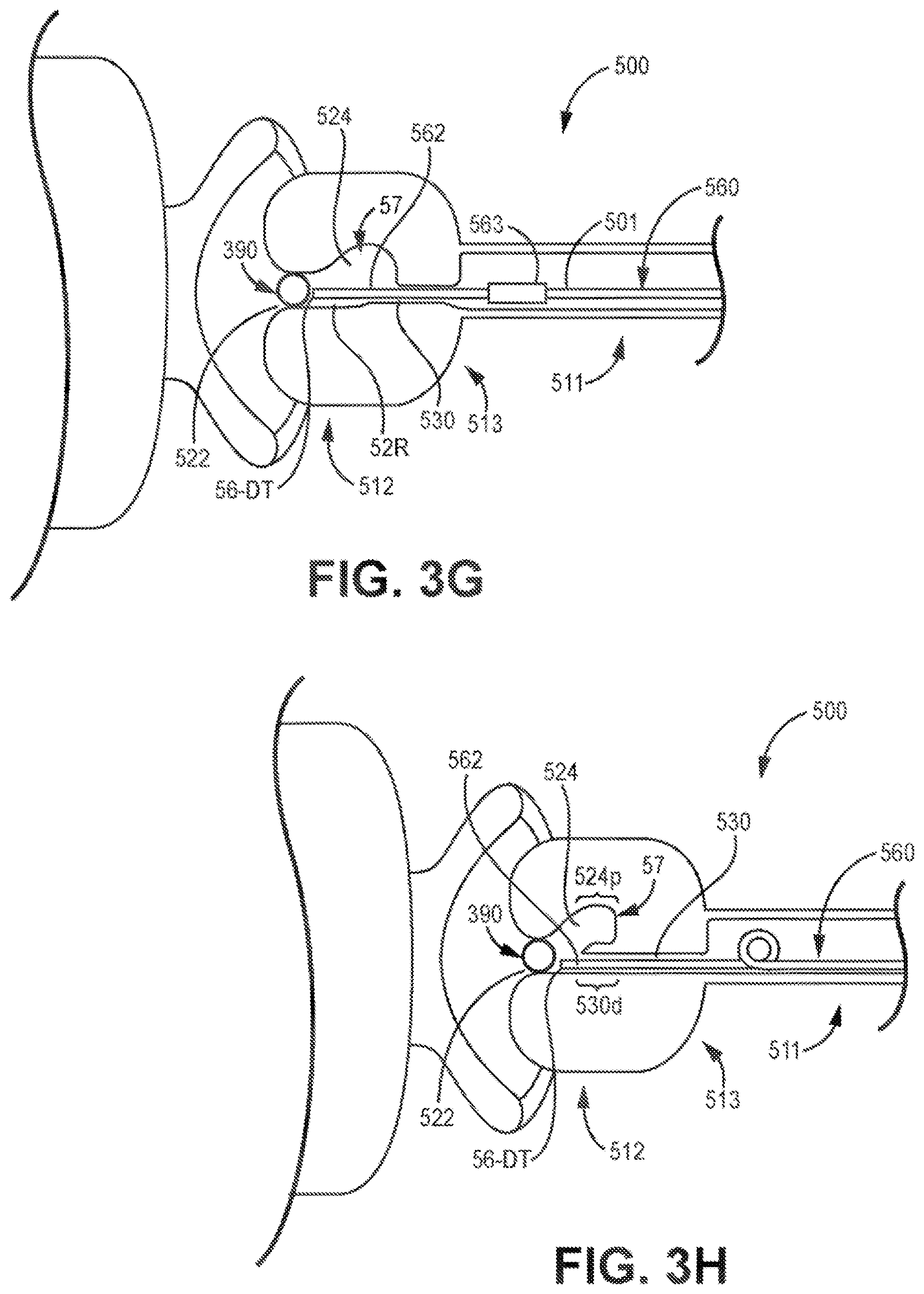 Patent US12426921 Figure 10 – Interventional medical systems and associated assemblies