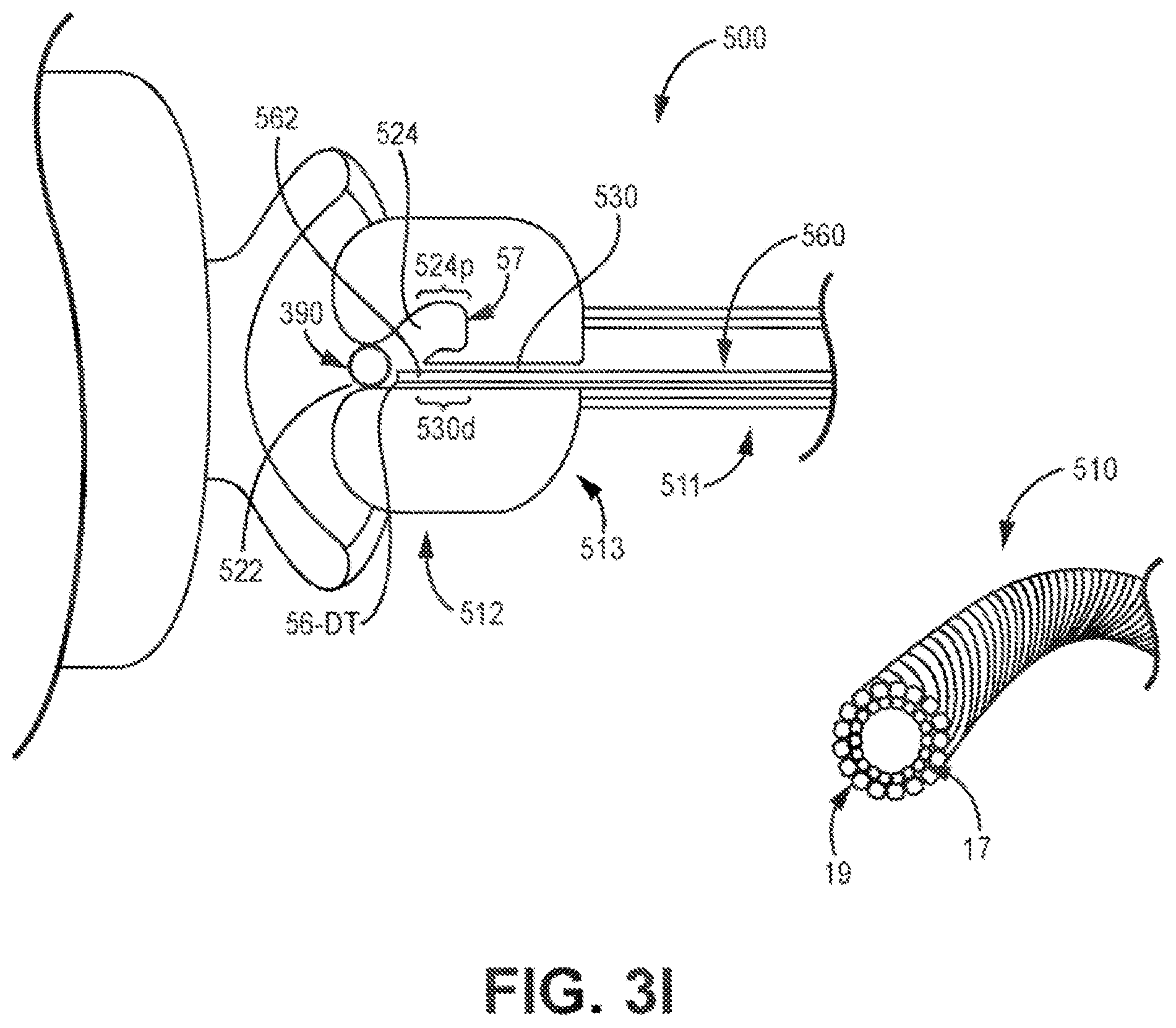 Patent US12426921 Figure 11 – Interventional medical systems and associated assemblies