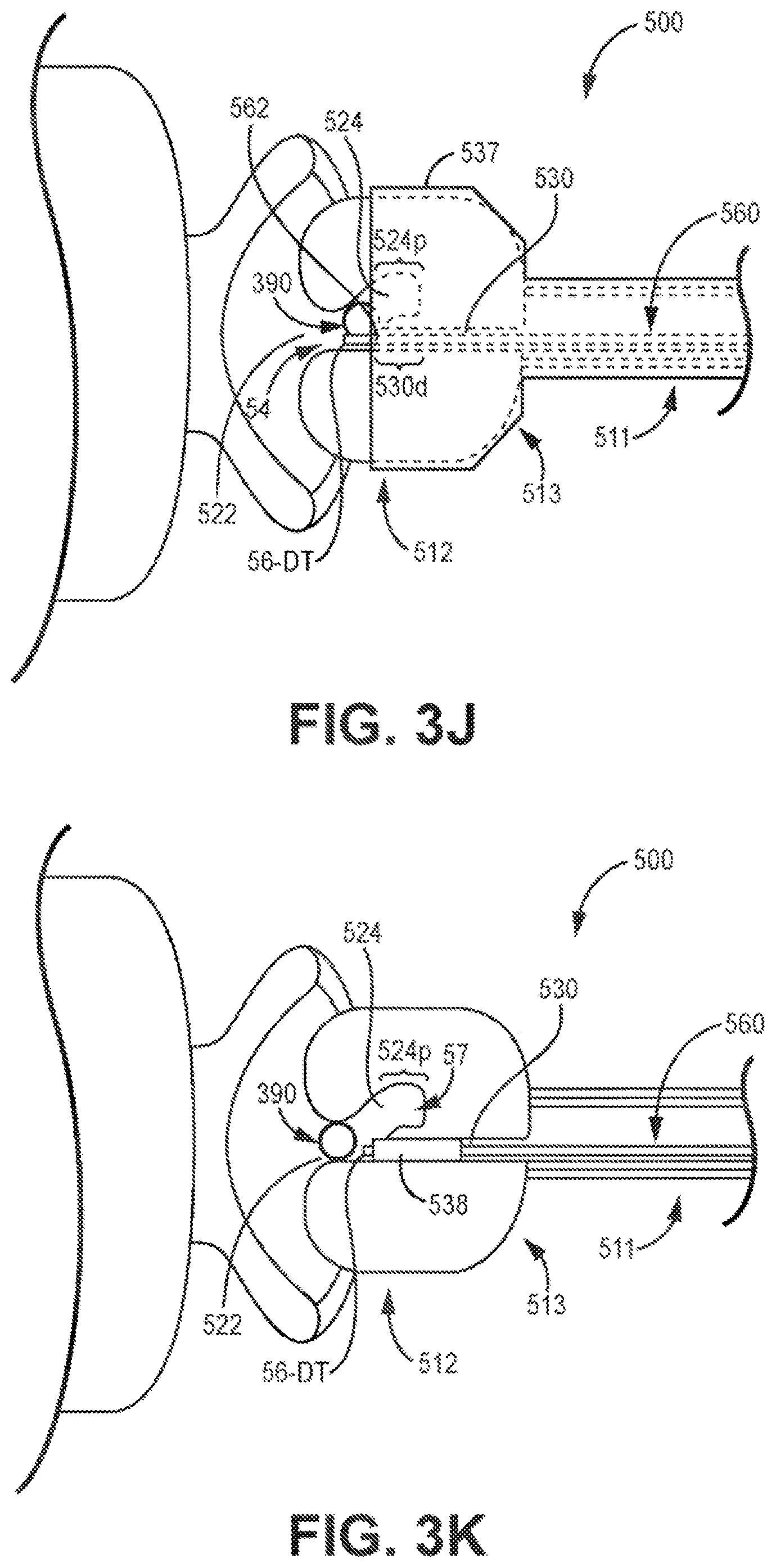 Patent US12426921 Figure 12 – Interventional medical systems and associated assemblies