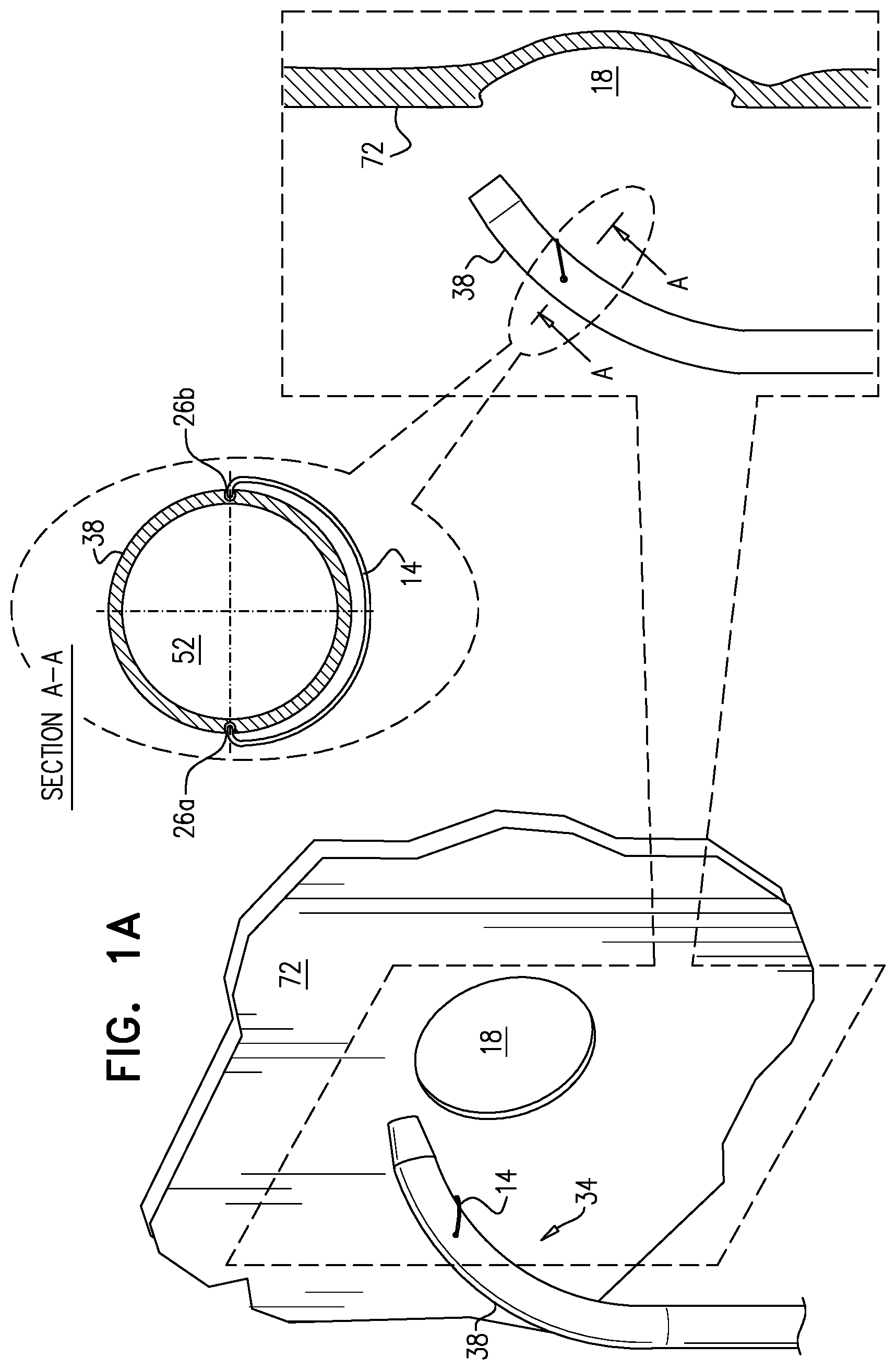 Patent US12426922 Figure 1 – Fossa ovalis penetration catheter