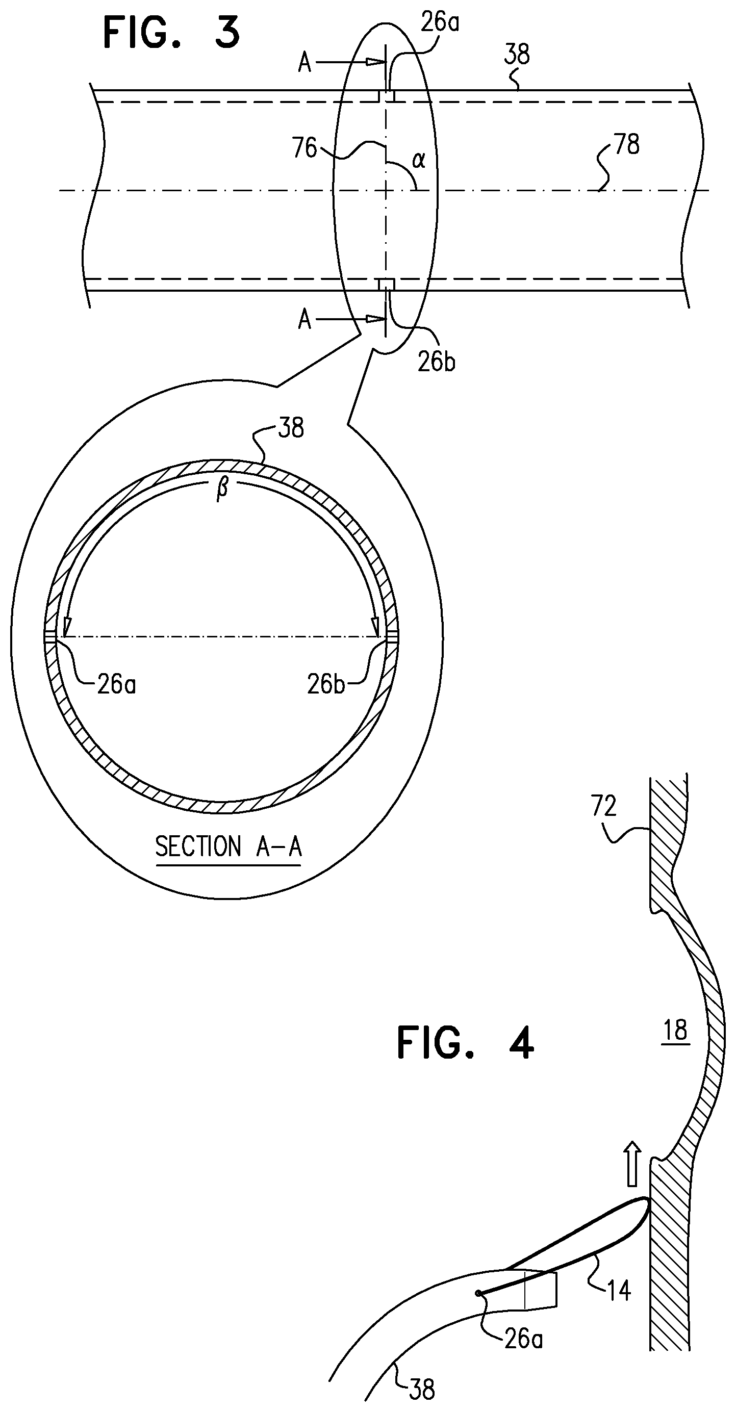 Patent US12426922 Figure 6 – Fossa ovalis penetration catheter