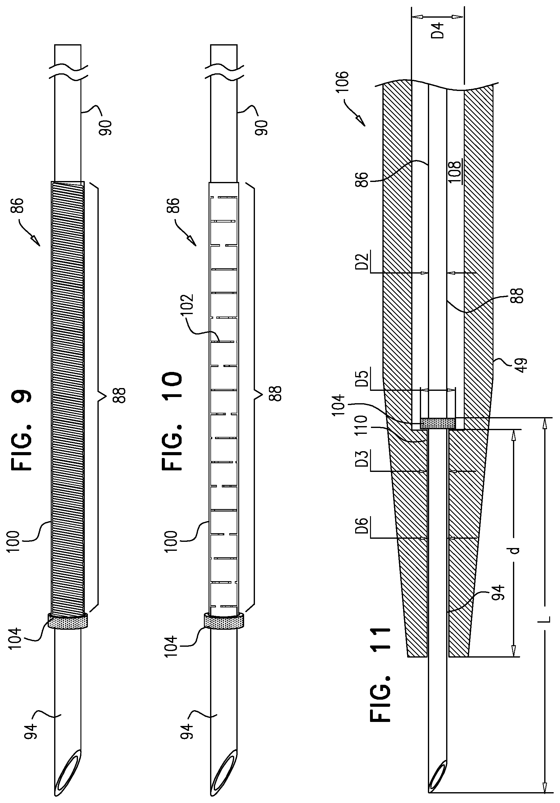 Patent US12426922 Figure 10 – Fossa ovalis penetration catheter
