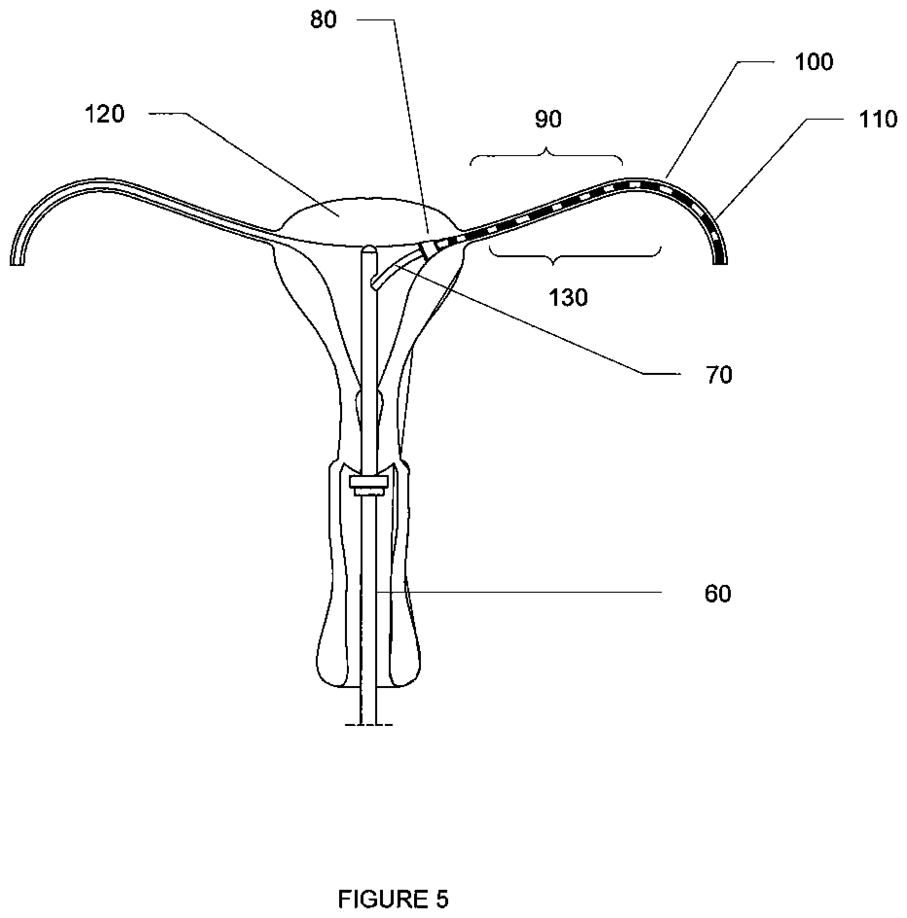 Patent US12426923 Figure 5 – Methods and devices for sonographic imaging