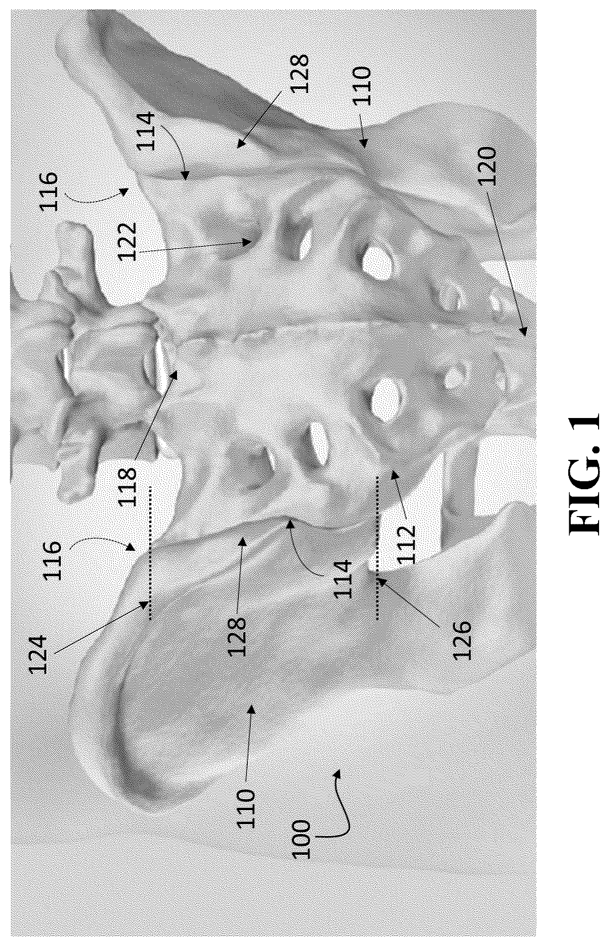 Patent US12426926 Figure 1 – Hybrid approach methods for sacroiliac joint stabilization
