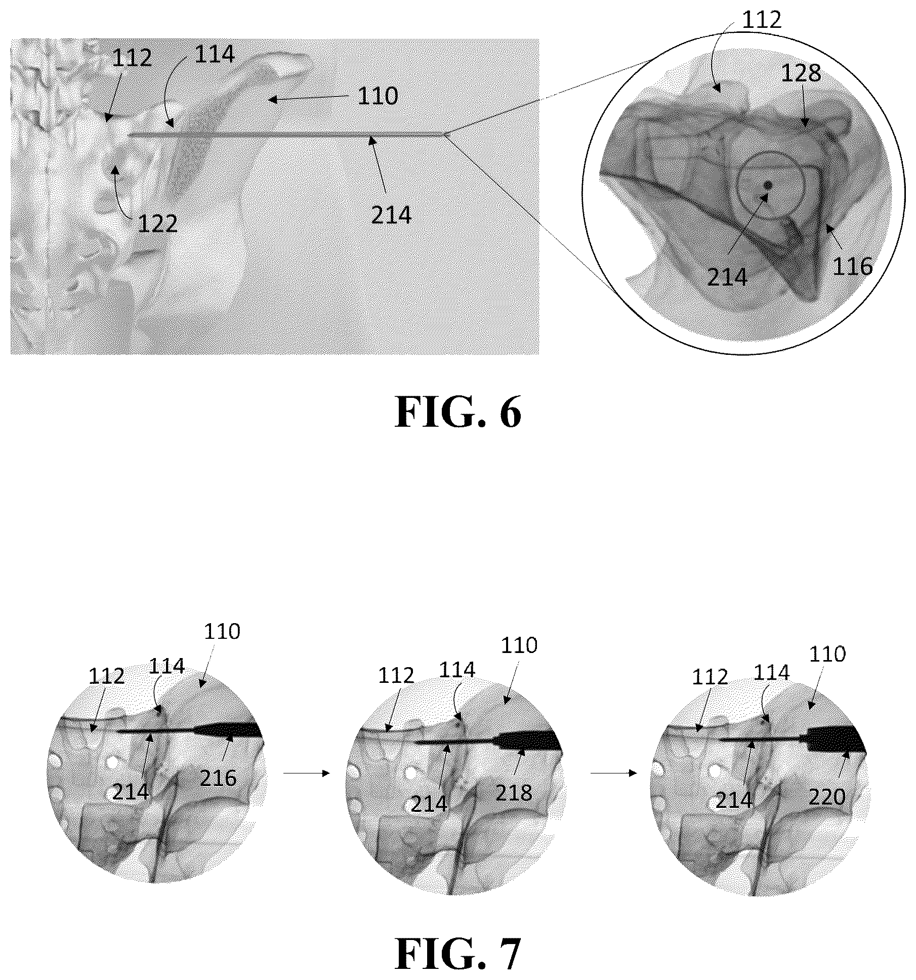 Patent US12426926 Figure 5 – Hybrid approach methods for sacroiliac joint stabilization