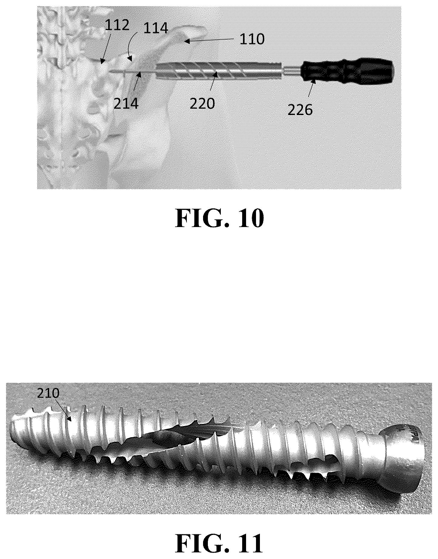Patent US12426926 Figure 7 – Hybrid approach methods for sacroiliac joint stabilization