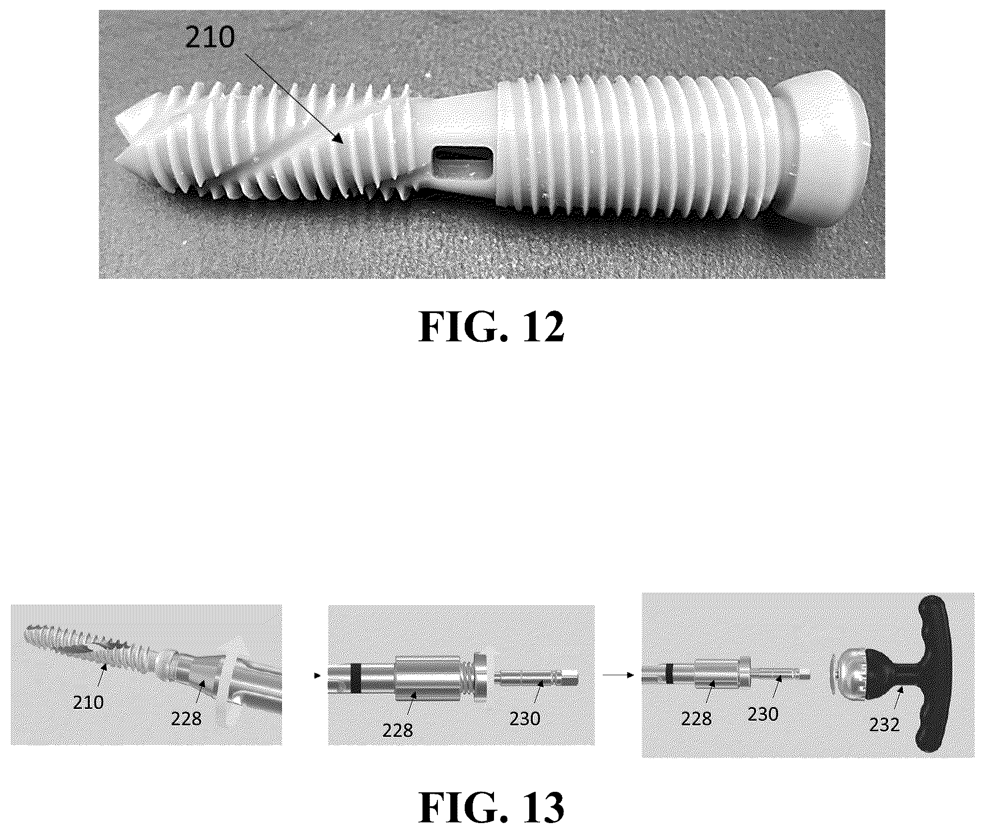 Patent US12426926 Figure 8 – Hybrid approach methods for sacroiliac joint stabilization