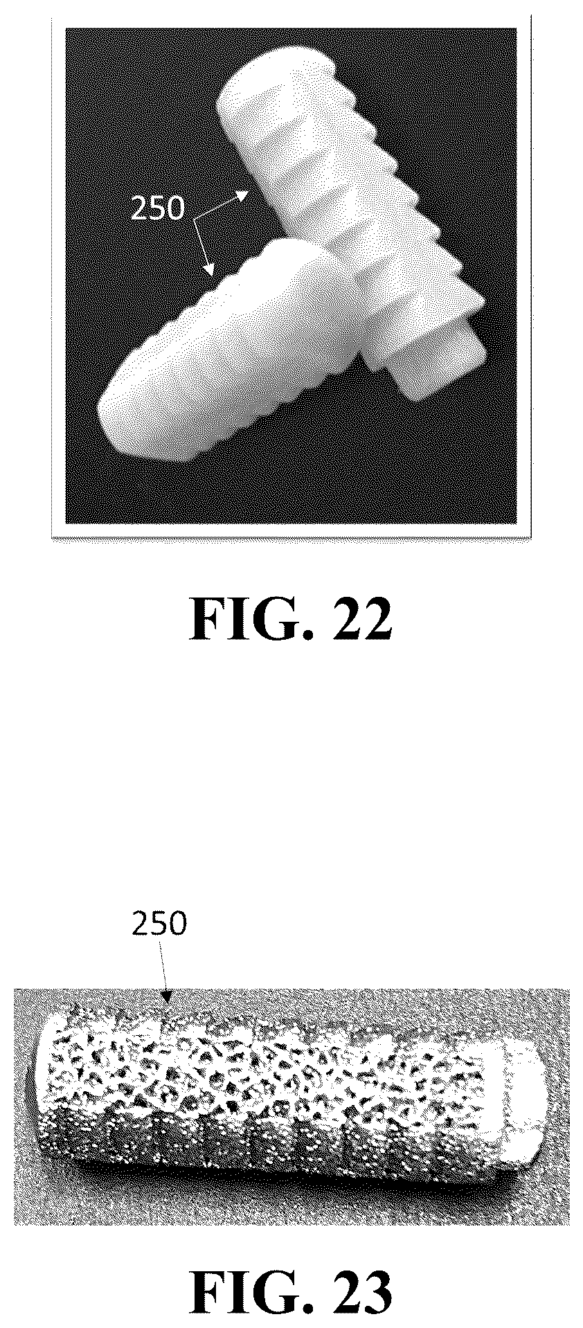 Patent US12426926 Figure 13 – Hybrid approach methods for sacroiliac joint stabilization