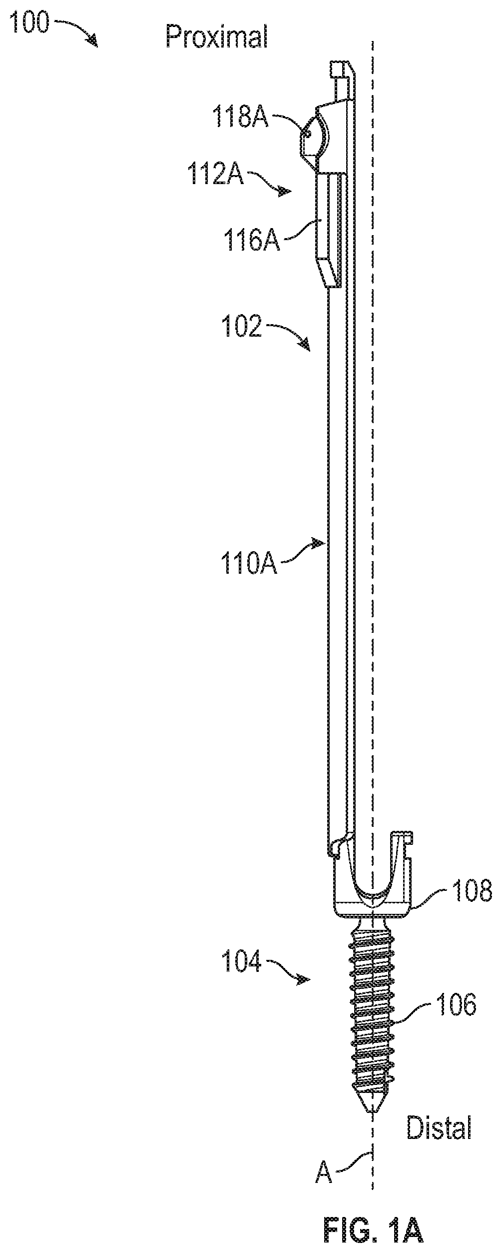 Patent US12426927 Figure 1 – Split tower for a bone anchor