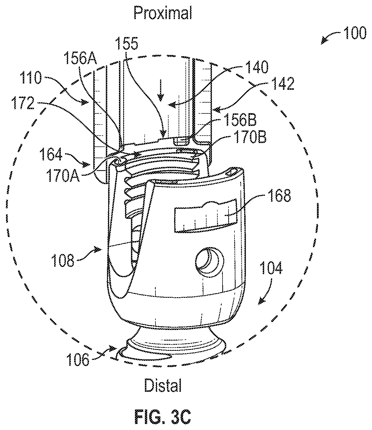 Patent US12426927 Figure 6 – Split tower for a bone anchor