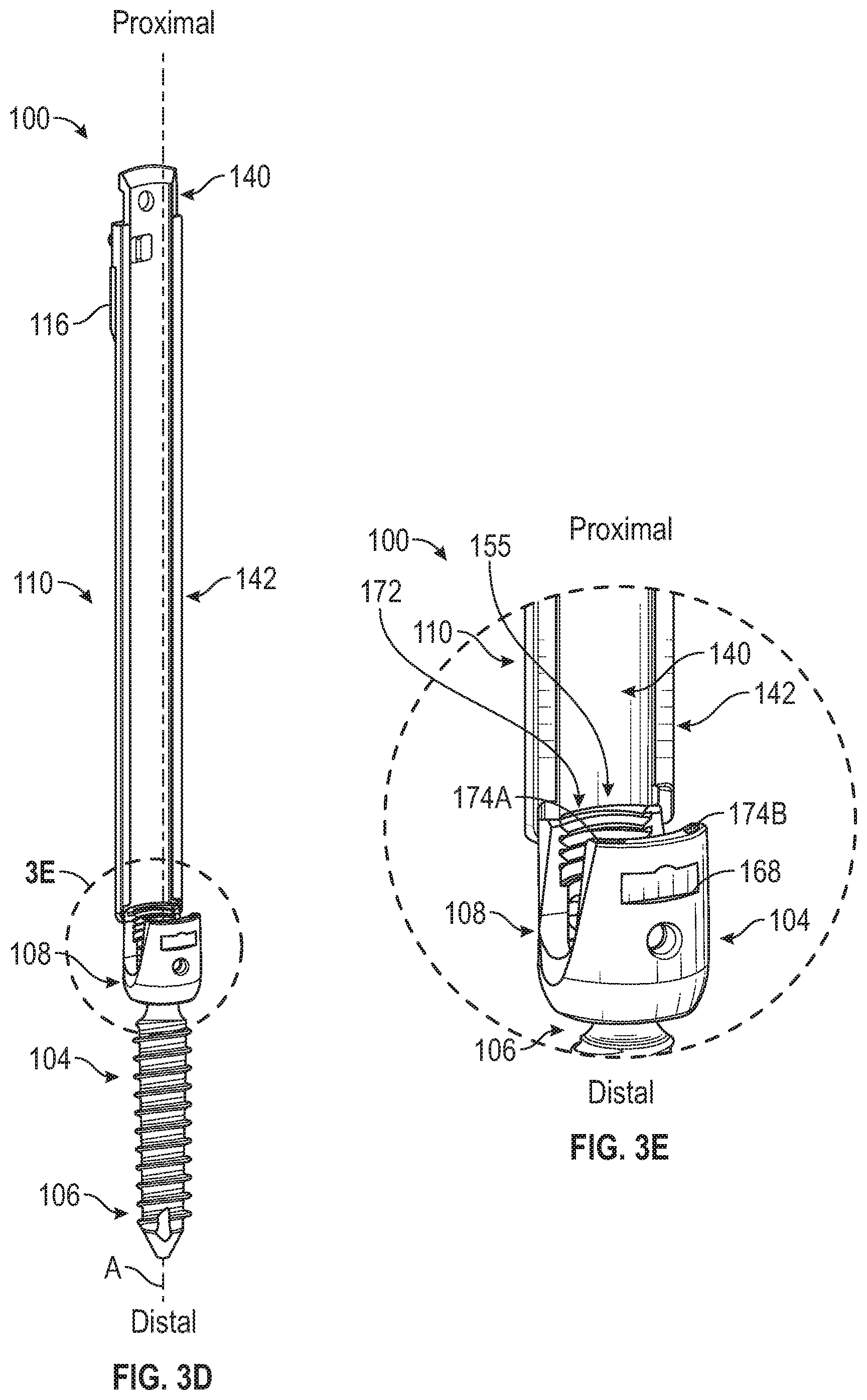 Patent US12426927 Figure 7 – Split tower for a bone anchor
