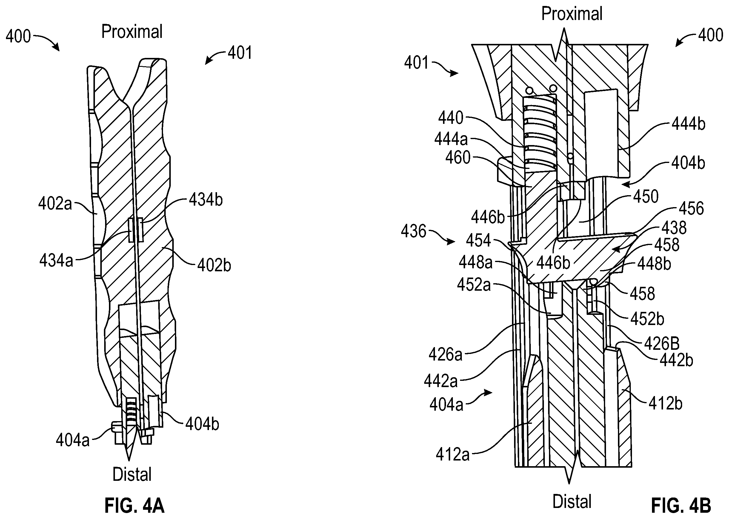 Patent US12426928 Figure 4 – Extended tab separation apparatus and method