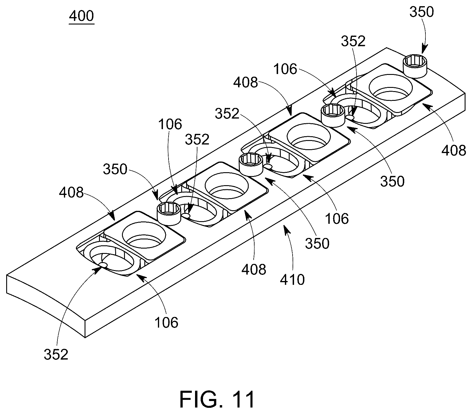 Patent US12426929 Figure 11 – Dynamic bone plate and method of use