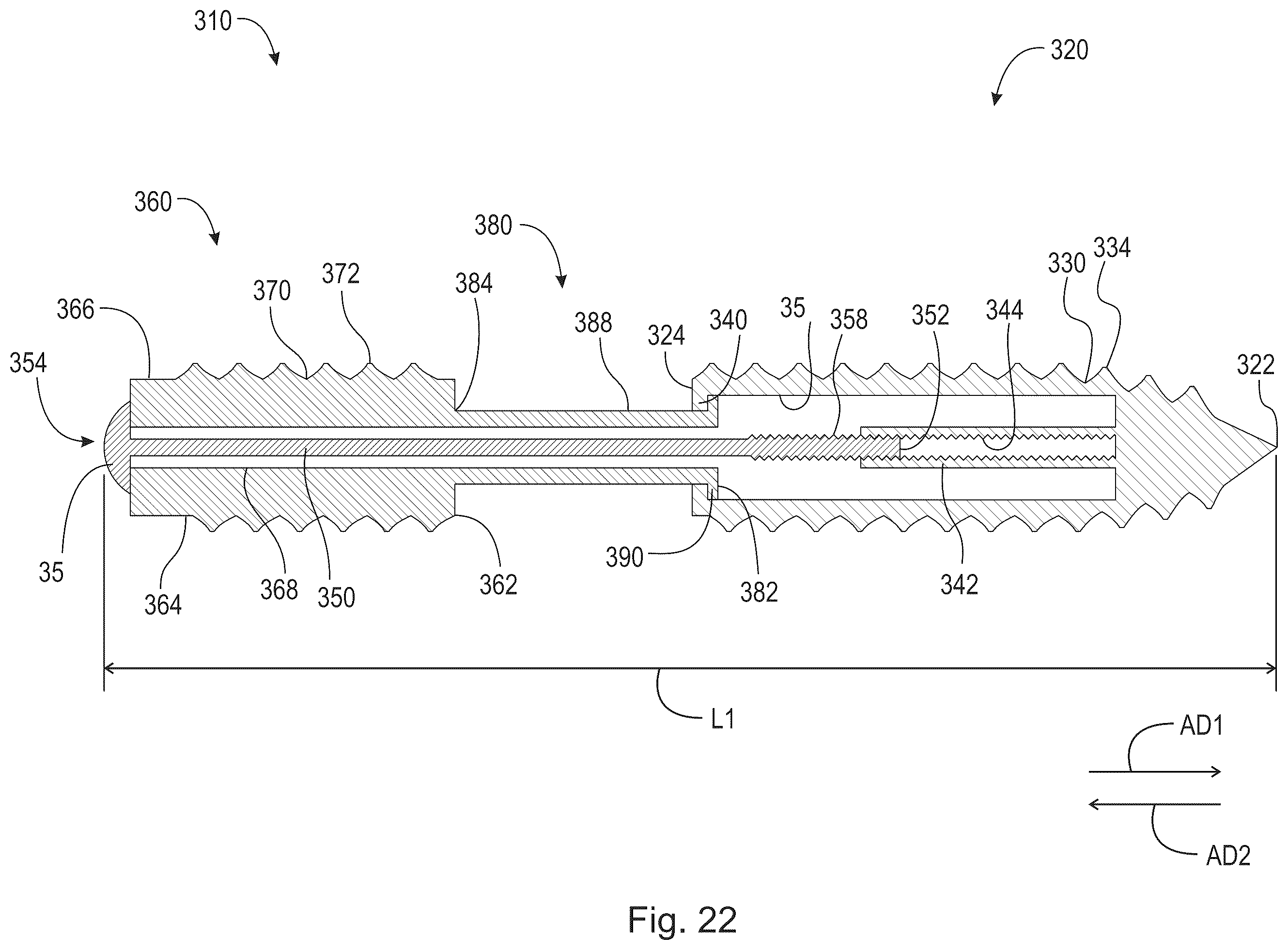Patent US12426930 Figure 20 – Fusion device